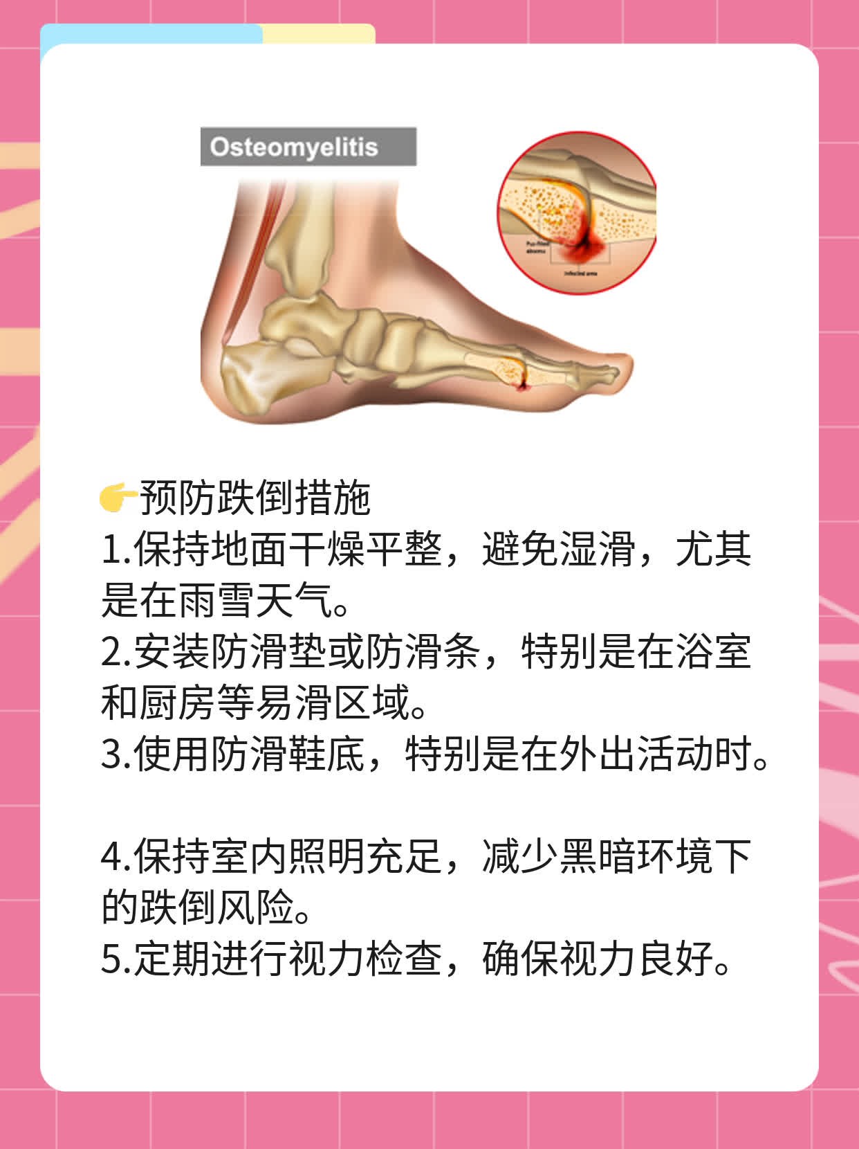 「经验分享」老年骨质疏松症状大盘点！