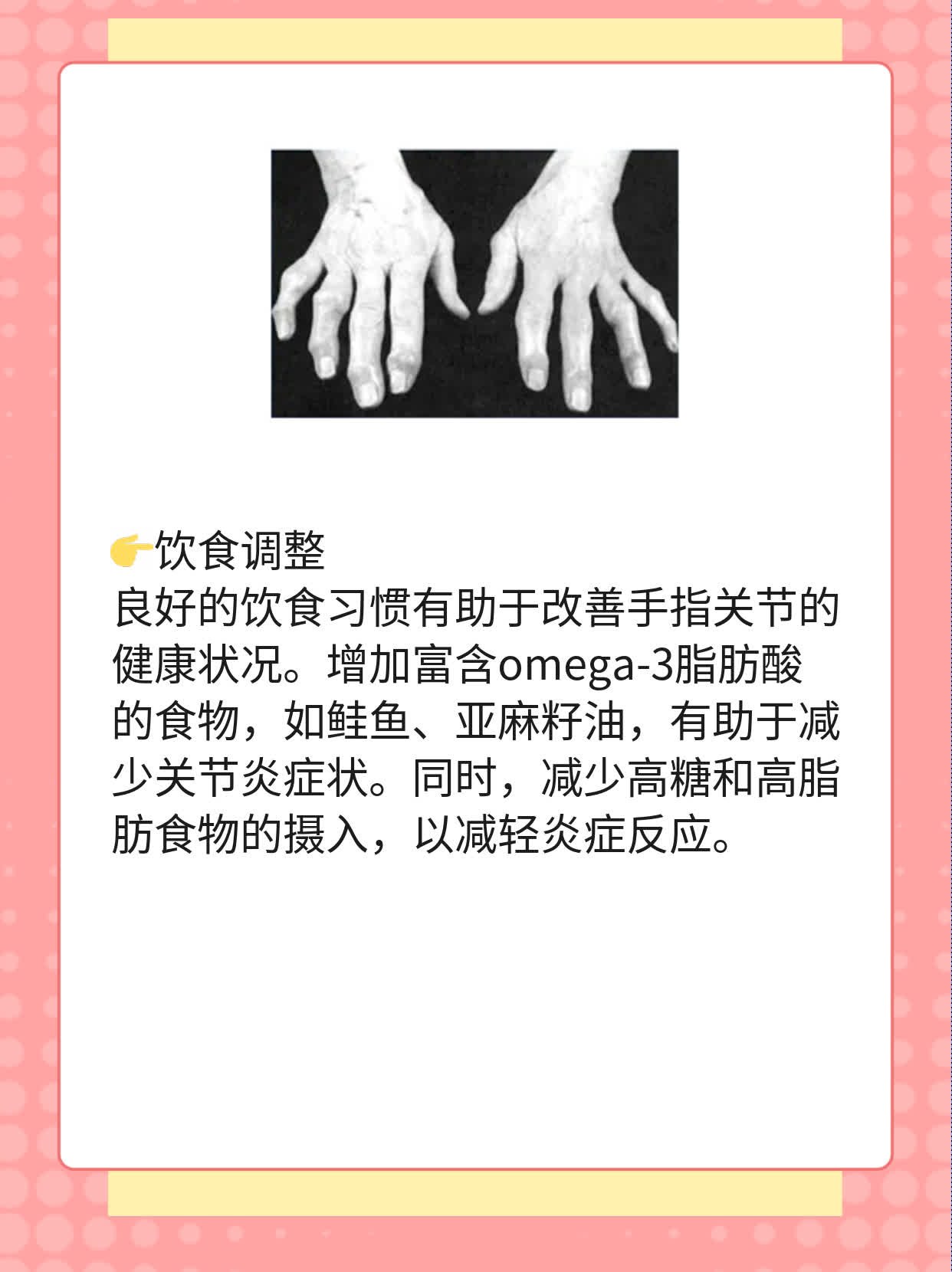 「手疼」？揭秘手指关节痛真相及妙招！