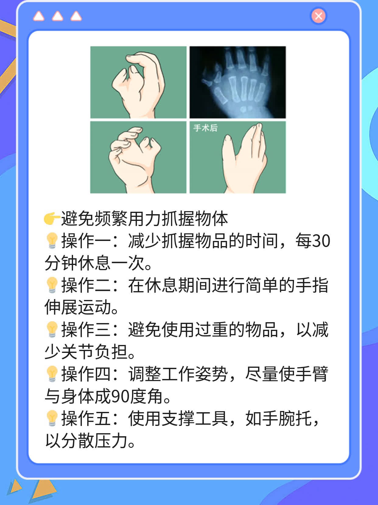 「手部肿胀」：揭秘手指关节肿胀的原因及处理方法！