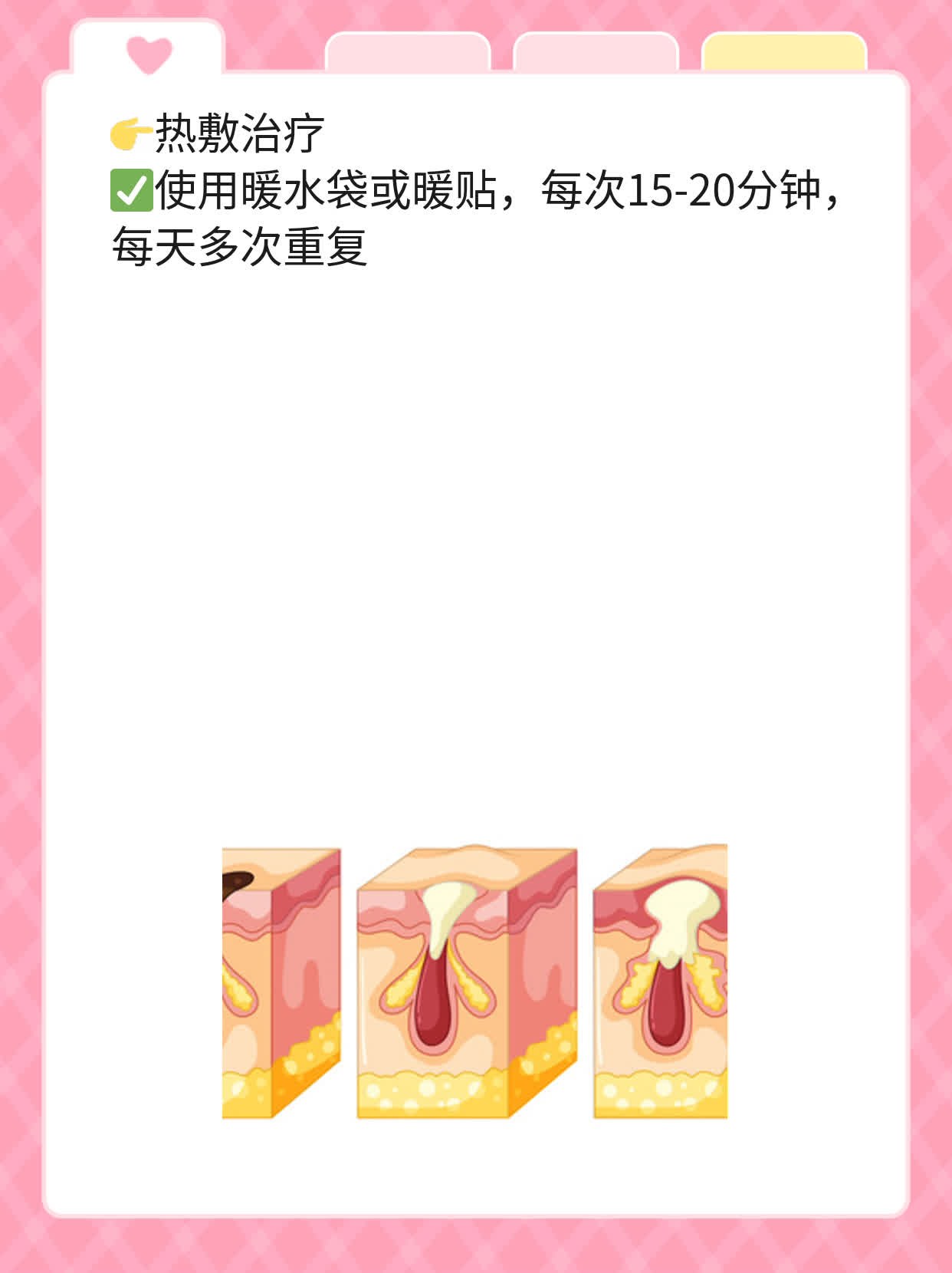 「分享」腰椎间盘膨出的治疗方法大全！