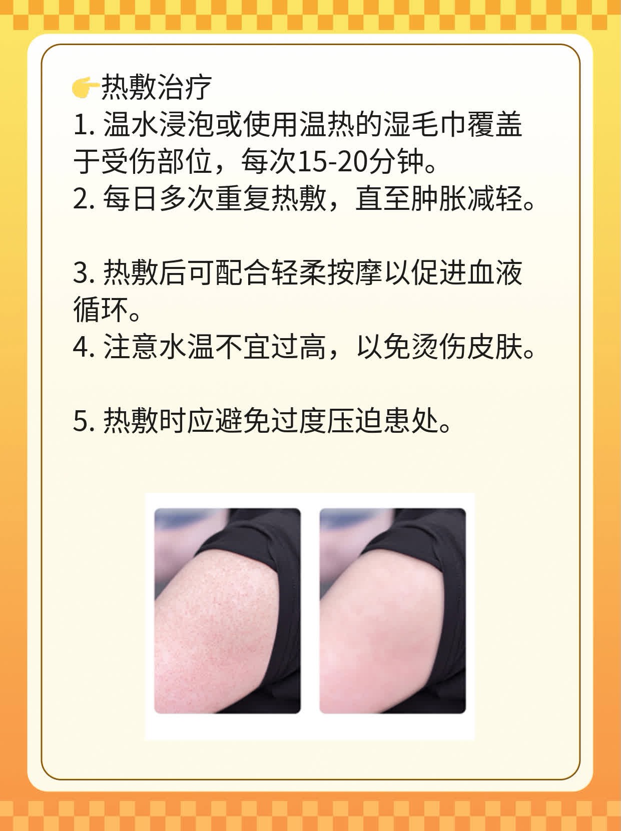 「脚踝扭伤」快速消肿攻略