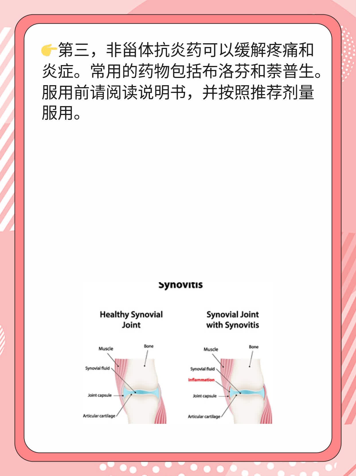「分享经验」：踝关节扭伤后的肿胀应对法