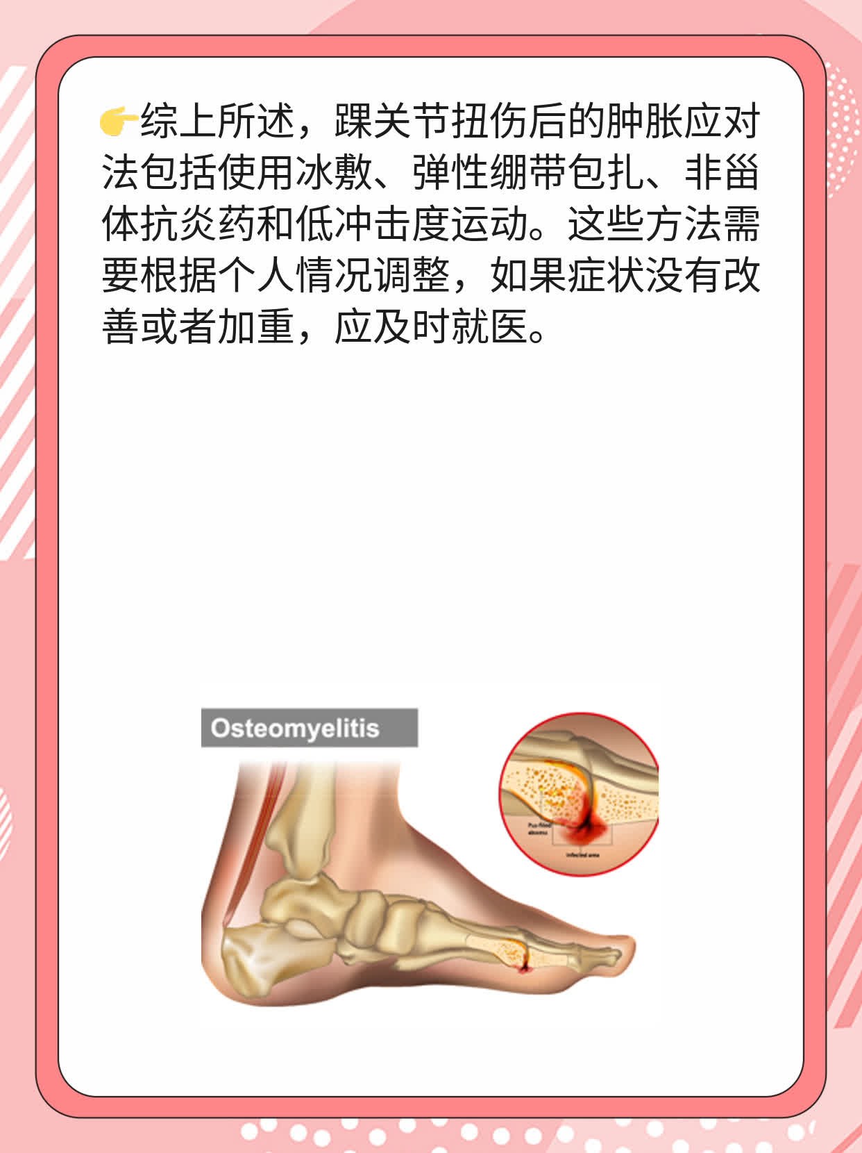 「分享经验」：踝关节扭伤后的肿胀应对法