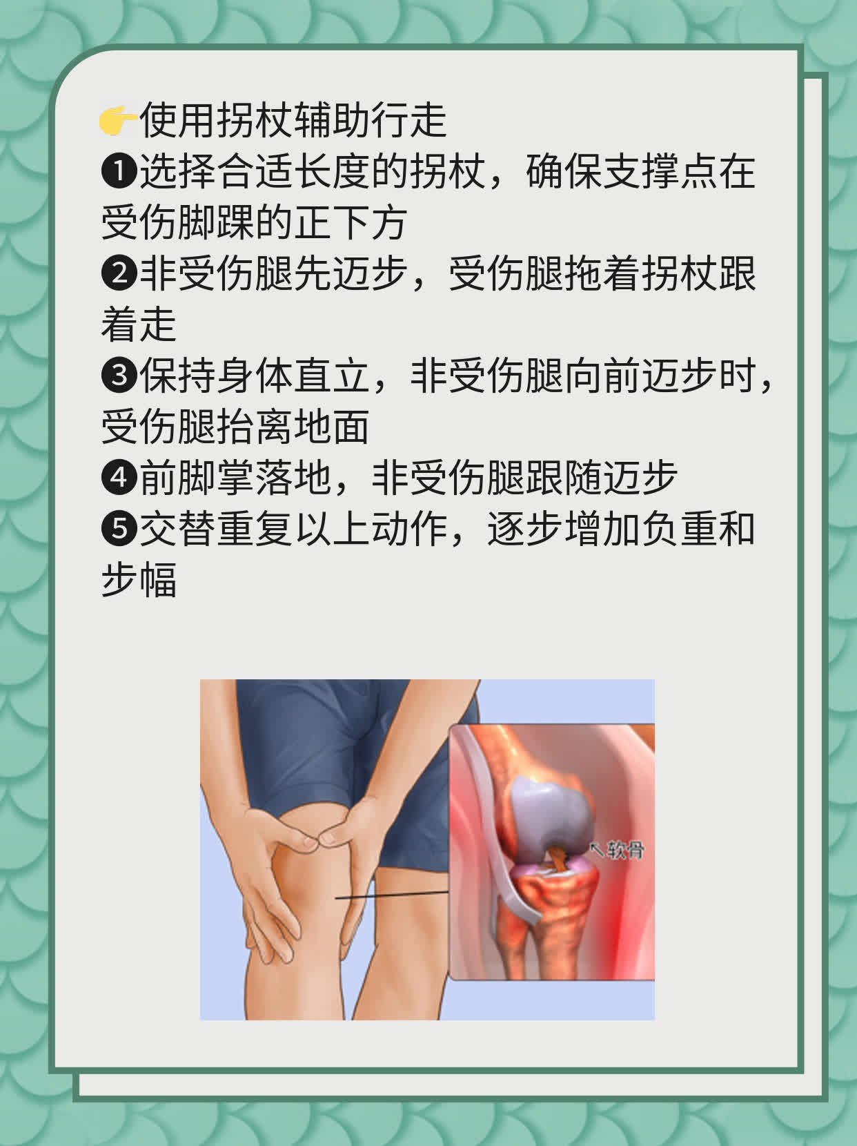 「揭秘」脚踝撕脱性骨折后仍能行走之谜