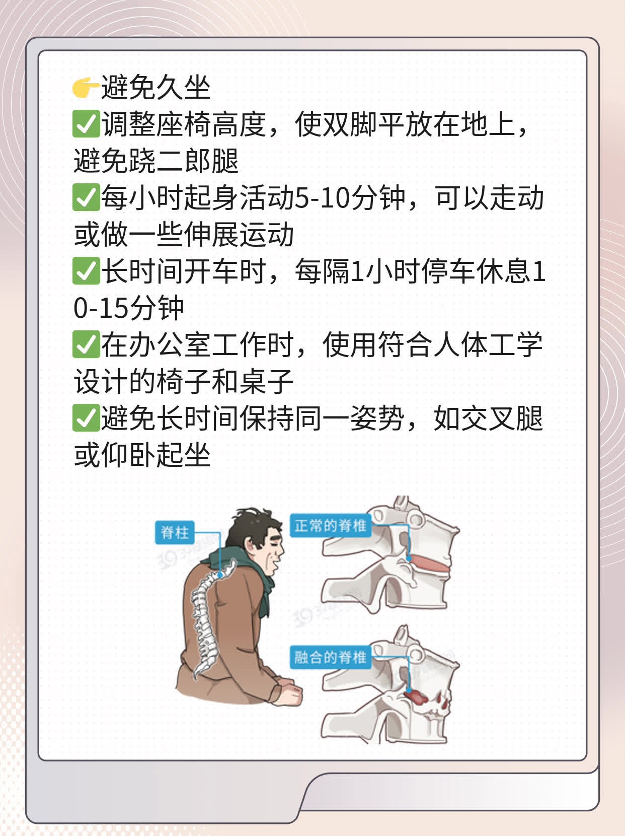 「解决你的烦恼」：坐骨神经痛最佳止痛药物大公开！