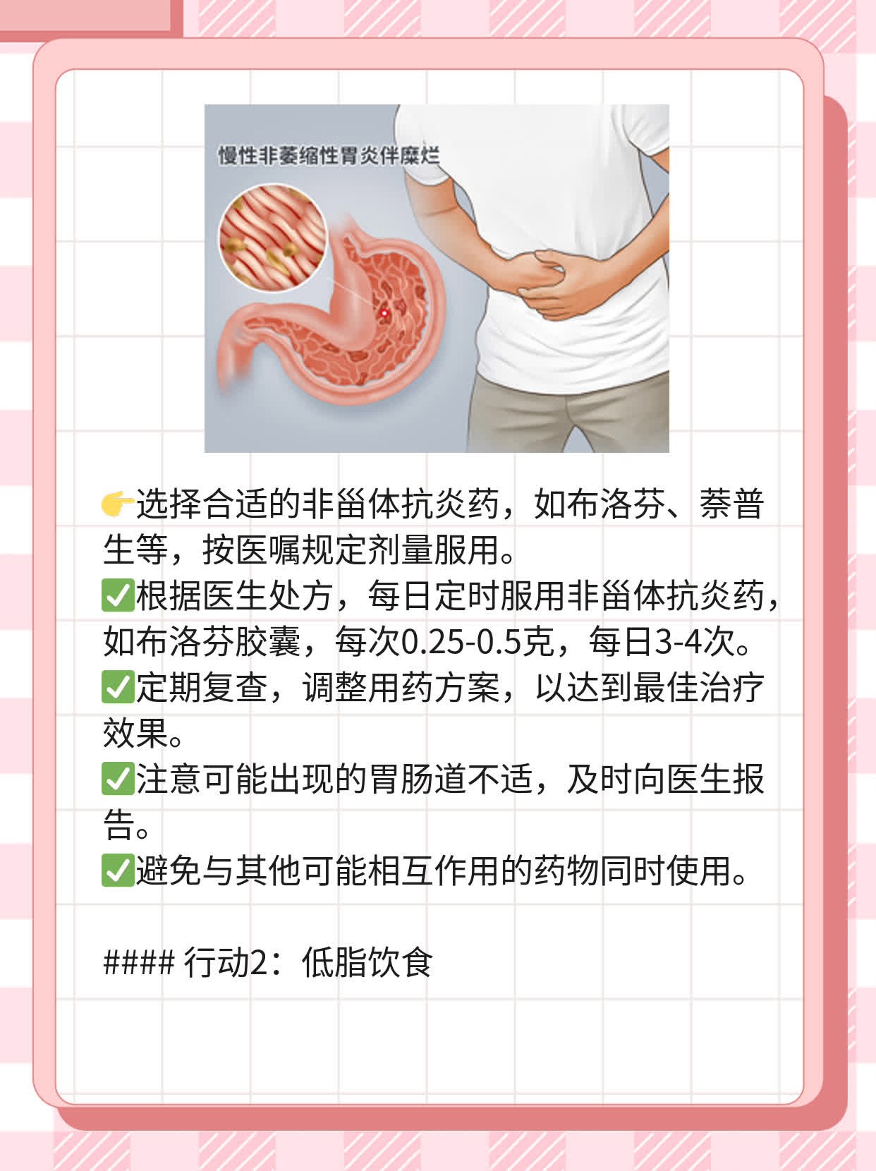 类风湿性关节炎用药指南：选择有效药物攻略