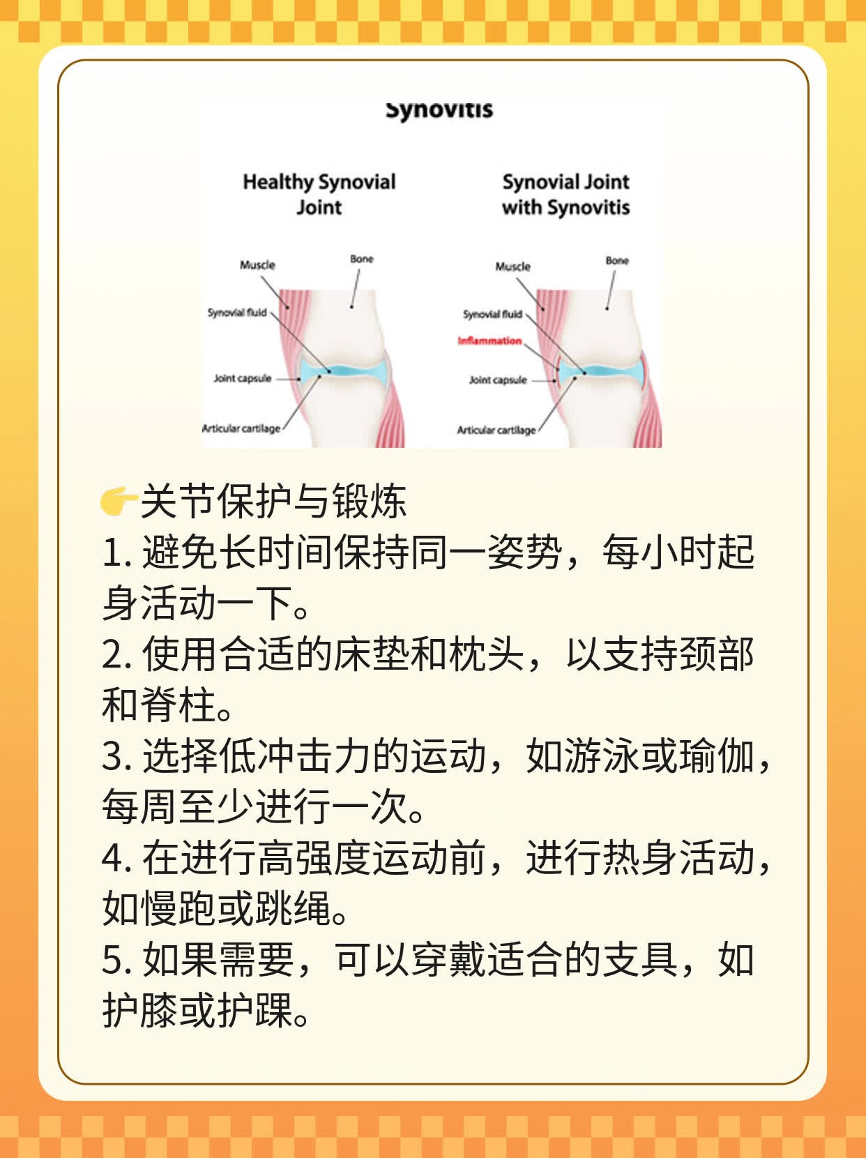 「类风湿性关节炎」家庭护理攻略