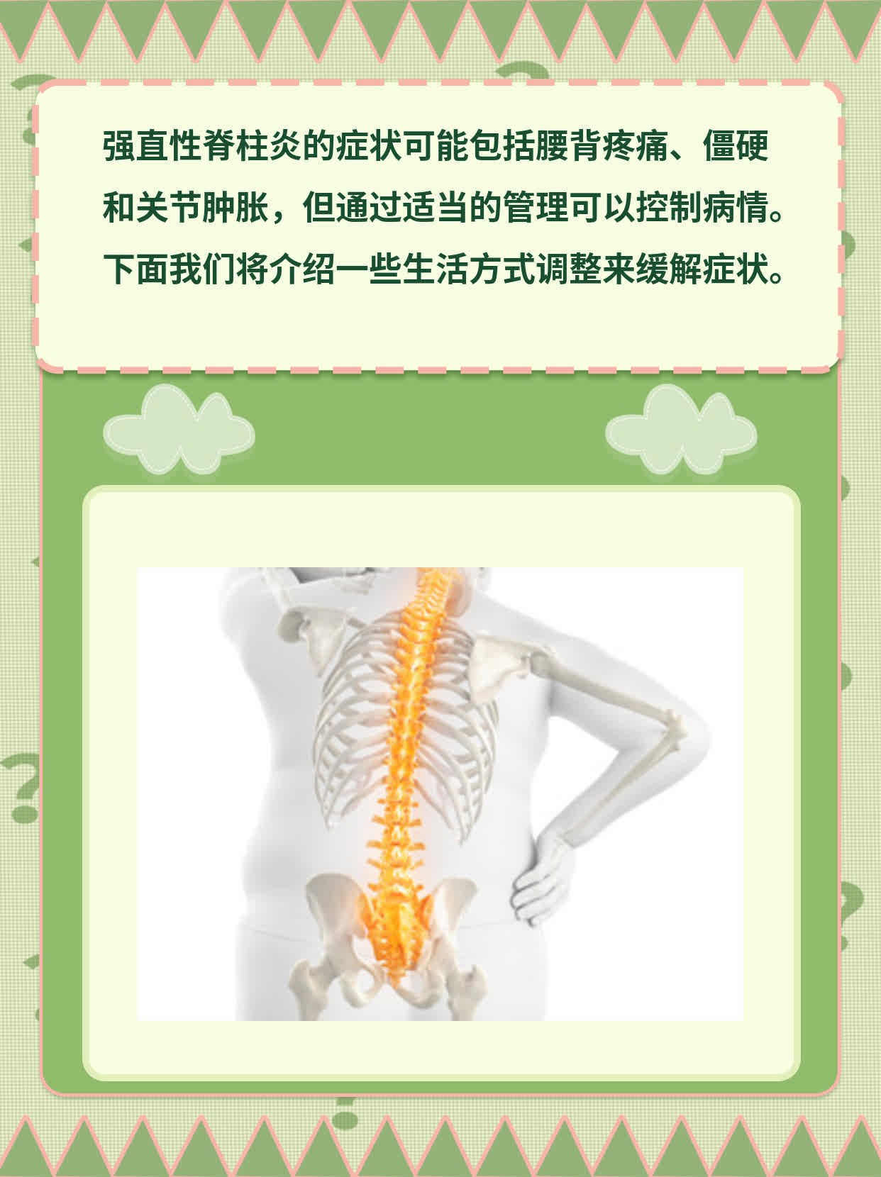 「强直性脊柱炎」的症状表现，你知道吗？