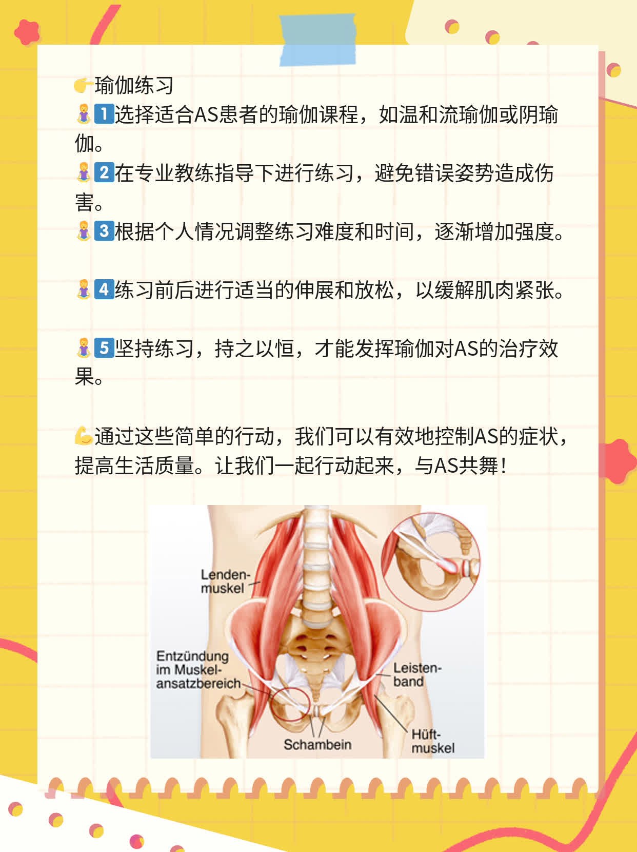 「AS经验谈」：强直性脊柱炎的症状一览表