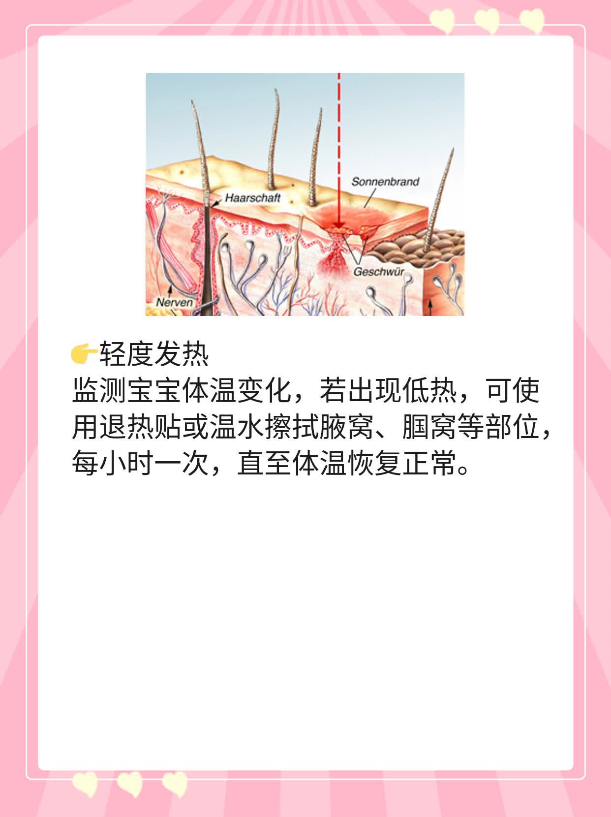 「育儿干货」幼儿急疹后出疹子护理妙招