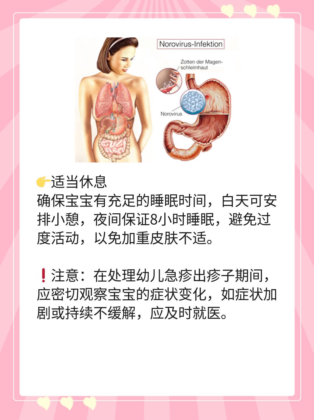 「育儿干货」幼儿急疹后出疹子护理妙招