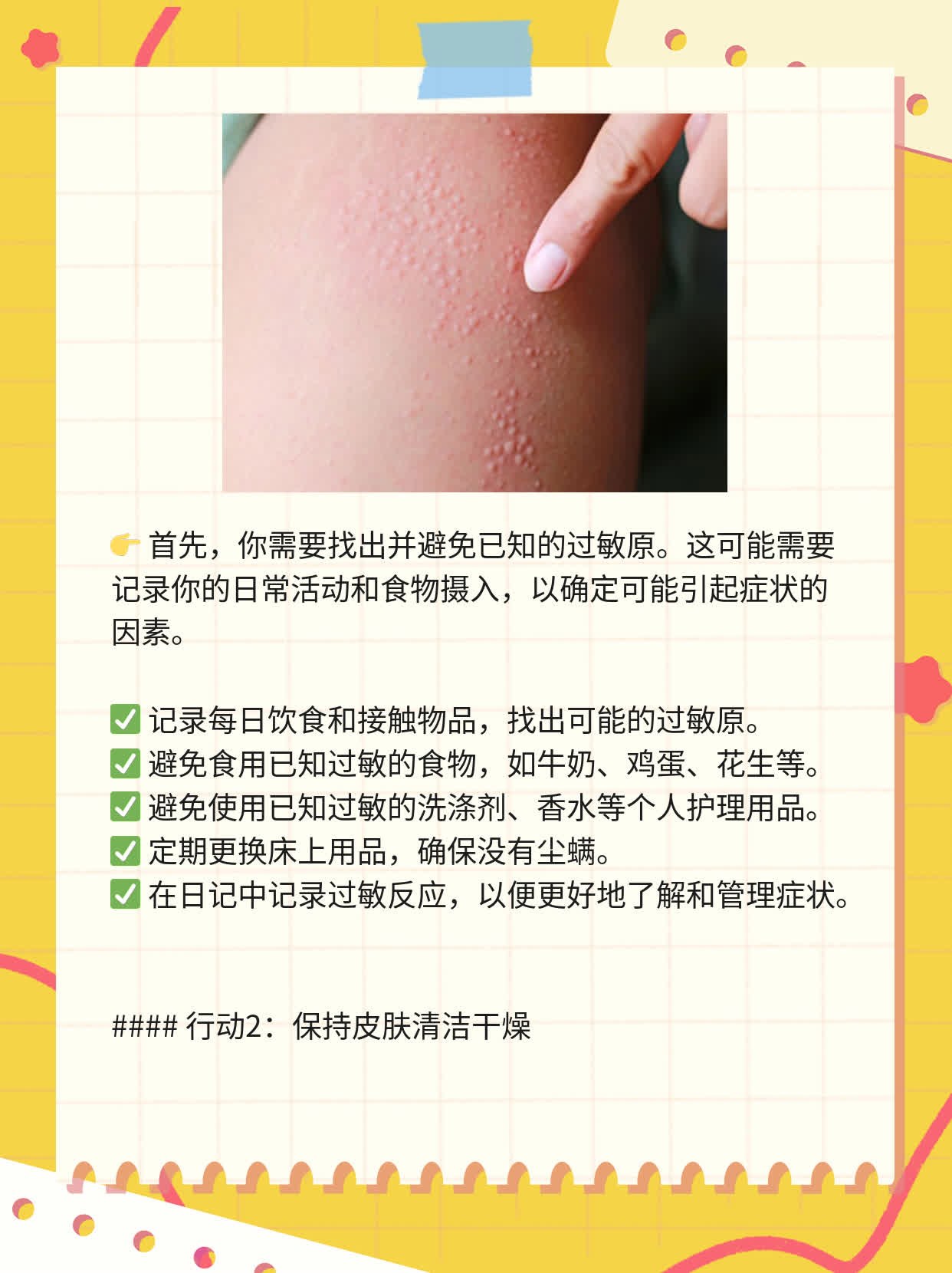 「自体敏感性湿疹」攻破腿部瘙痒红肿的战术图谱