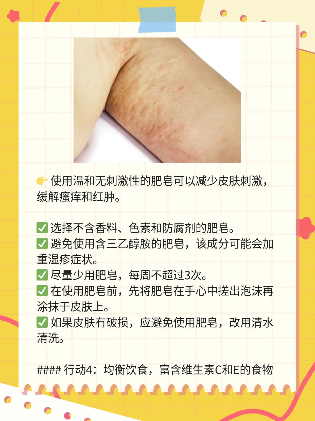 「自体敏感性湿疹」攻破腿部瘙痒红肿的战术图谱