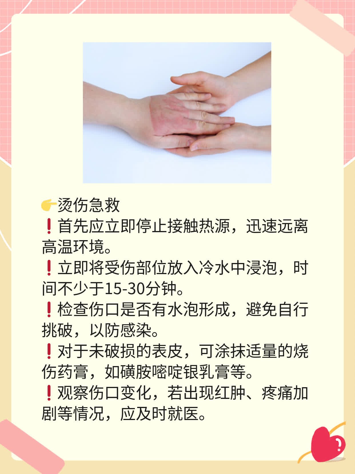 「烫伤急救」：快速处理小面积灼伤的妙招！