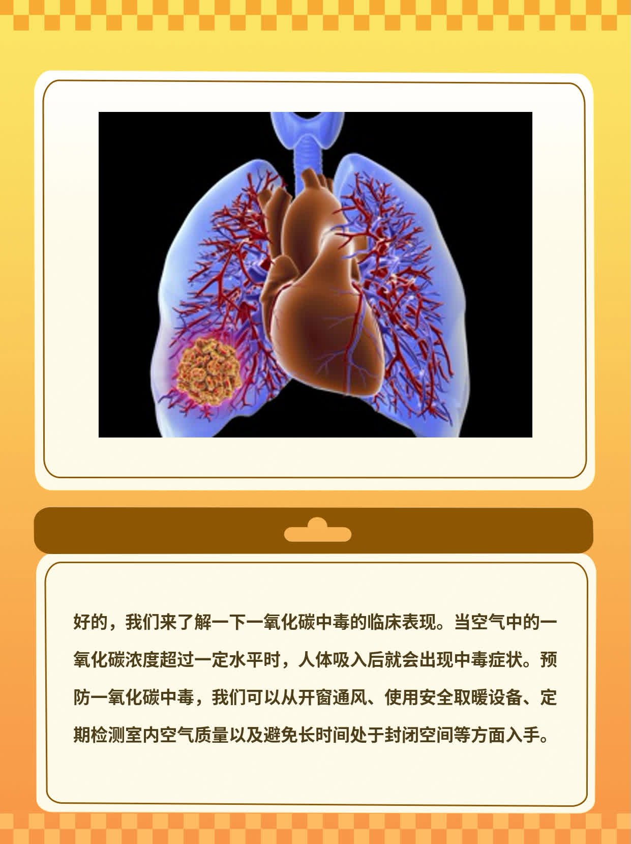 「一氧化碳中毒」的临床表现揭秘！