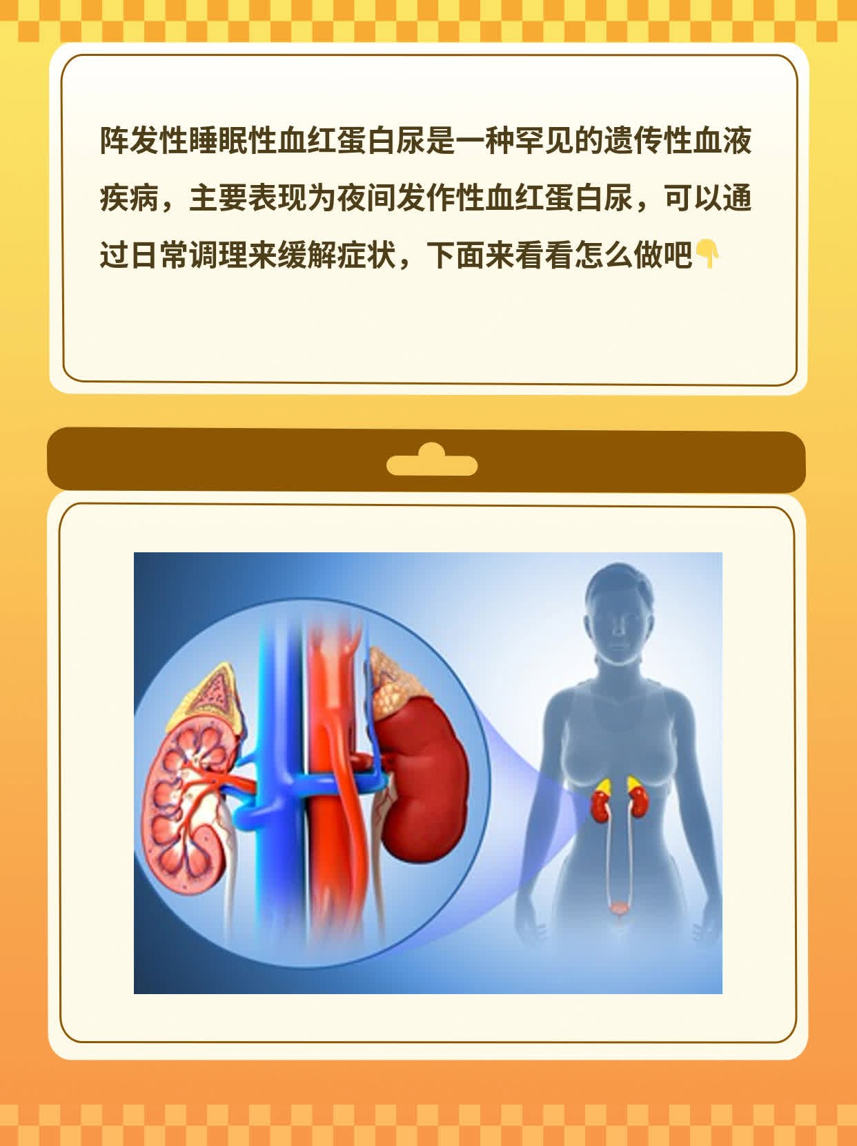 血红蛋白尿图片早期图片