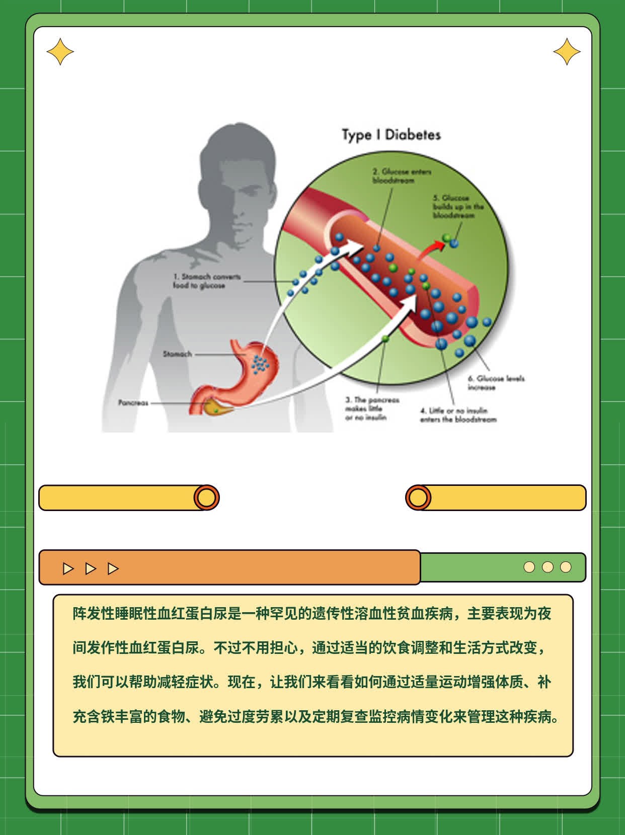 阵发性睡眠性血红蛋白尿解析