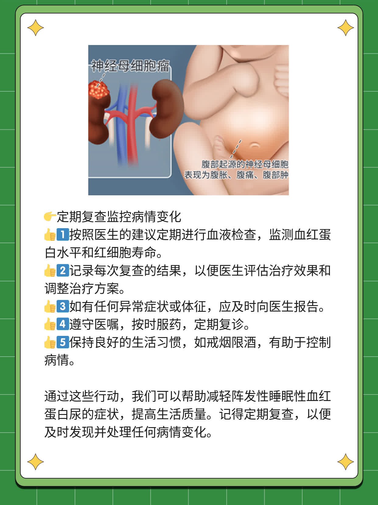 阵发性睡眠性血红蛋白尿解析