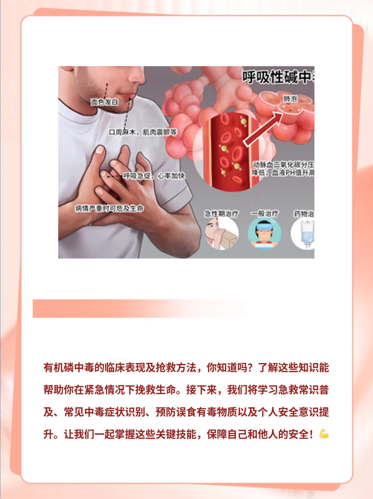 经验分享：有机磷中毒的临床表现及抢救方法