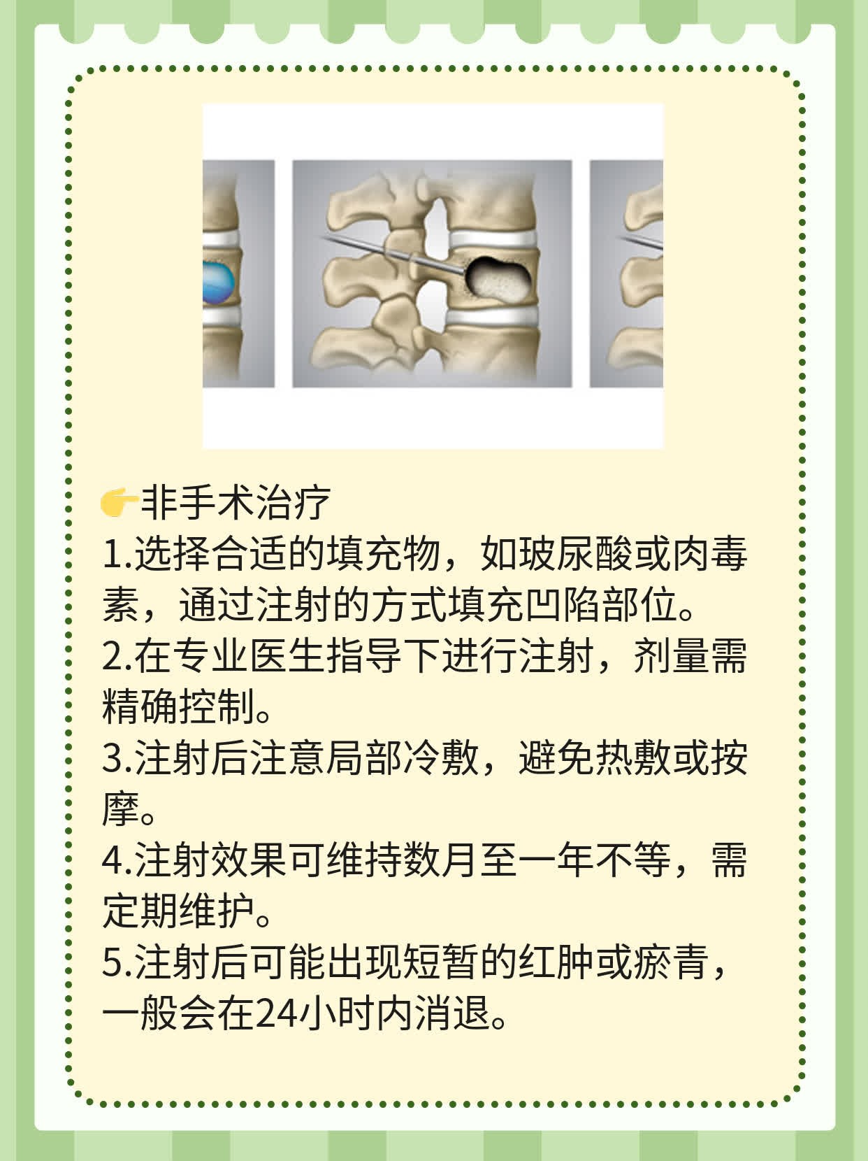 祛除川字纹的小妙招