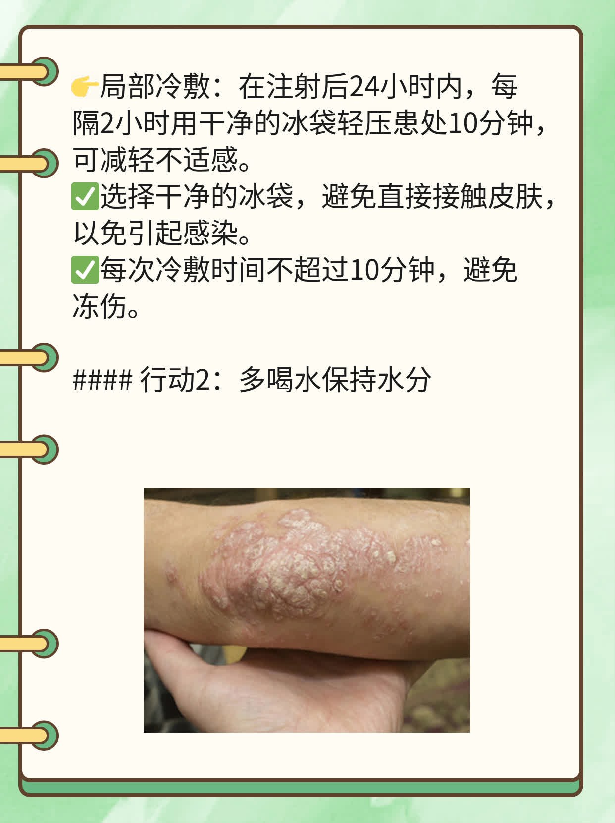 打完除皱针更显皱纹？解决妙招！