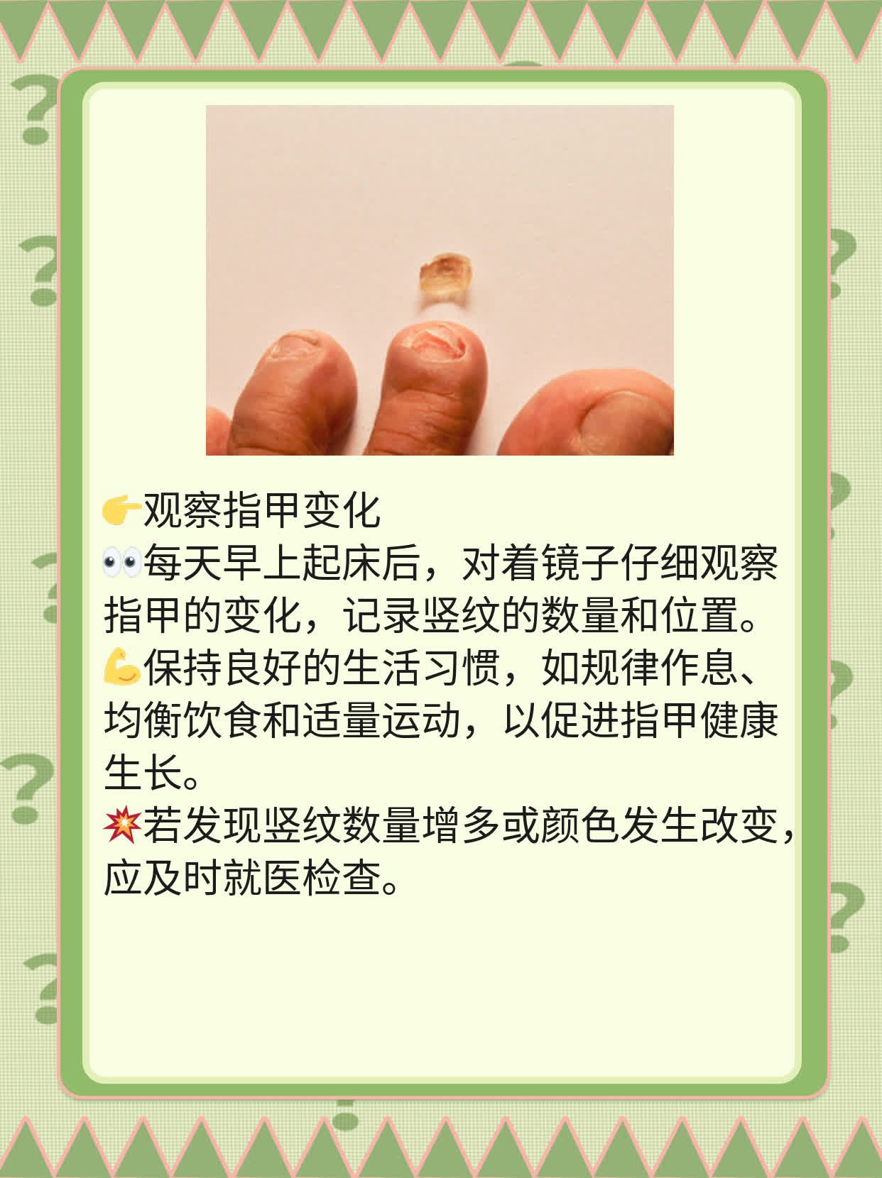 「揭秘」大拇指甲有竖纹，原来是...