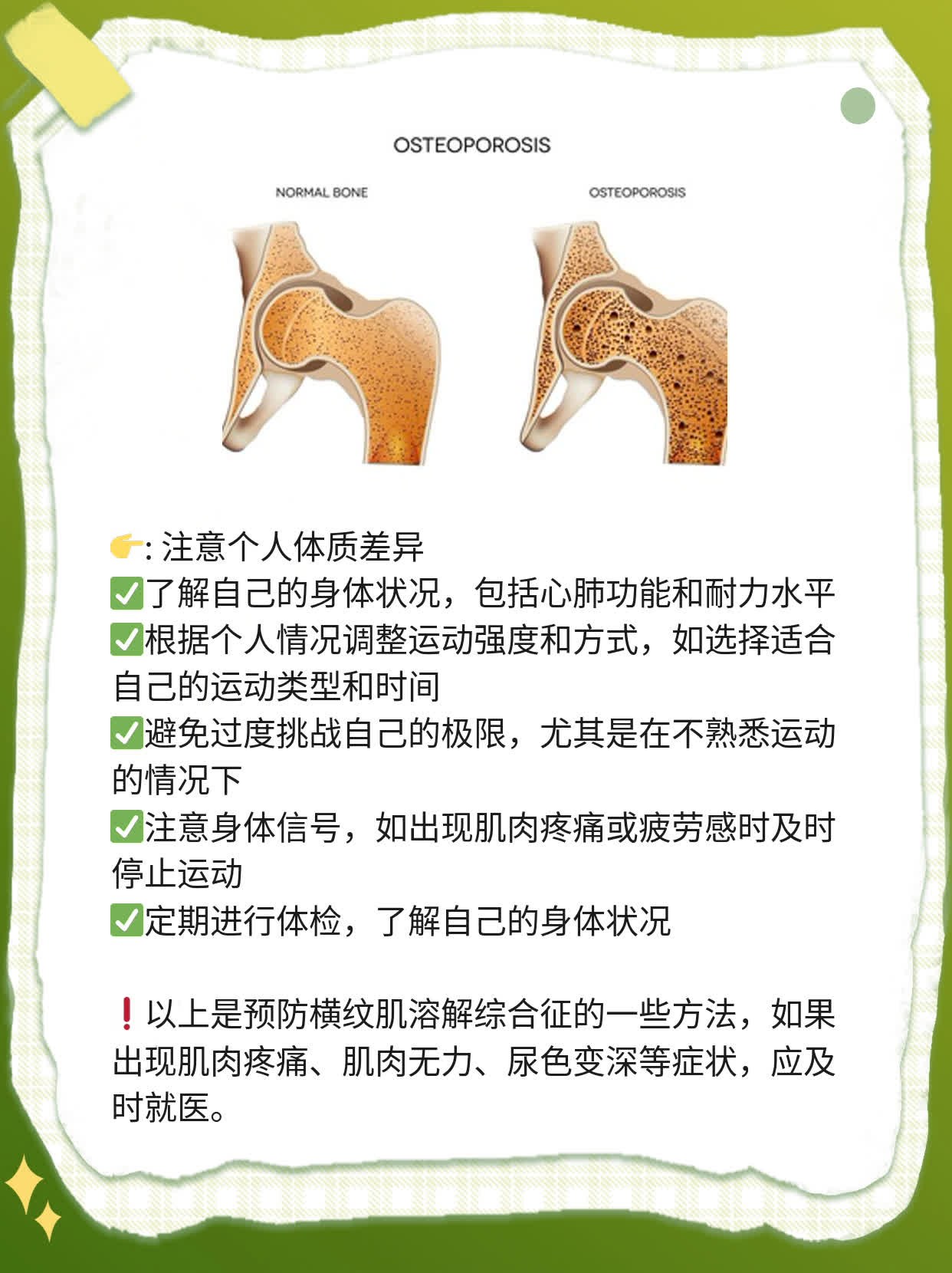 「解密」横纹肌溶解综合征：肌肉“崩溃”了？