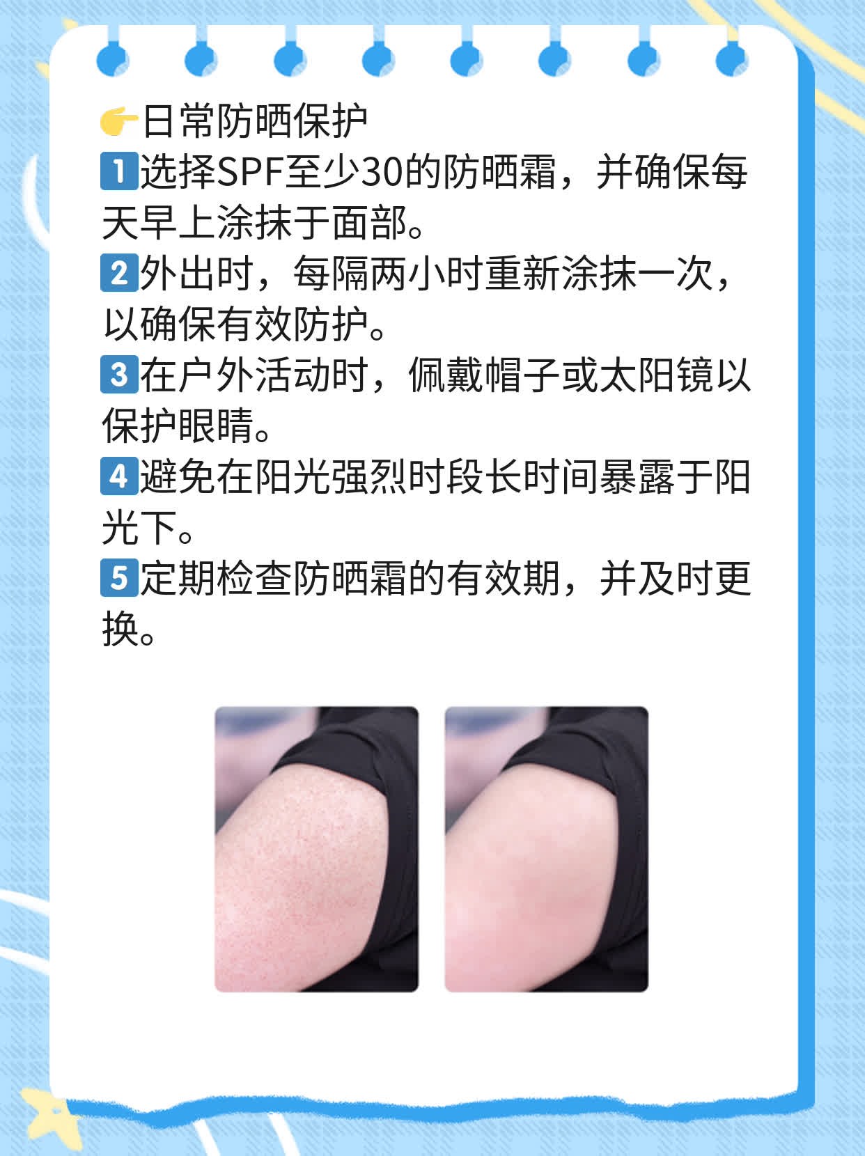 揭秘：脸部皱纹成因解析！