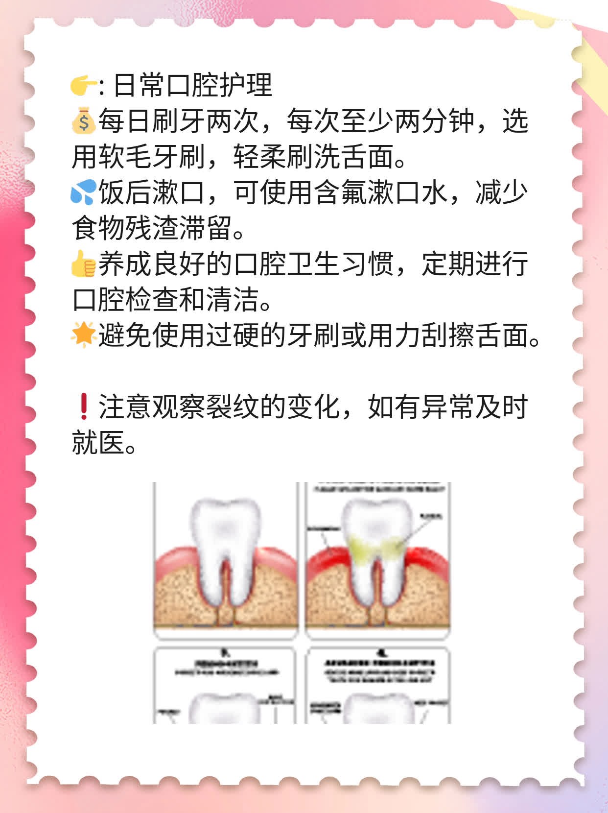 [经验分享]舌头裂纹原因及调护法门
