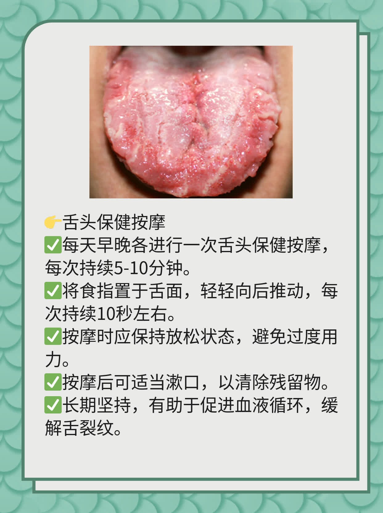 探秘舌中间裂纹：原因解析