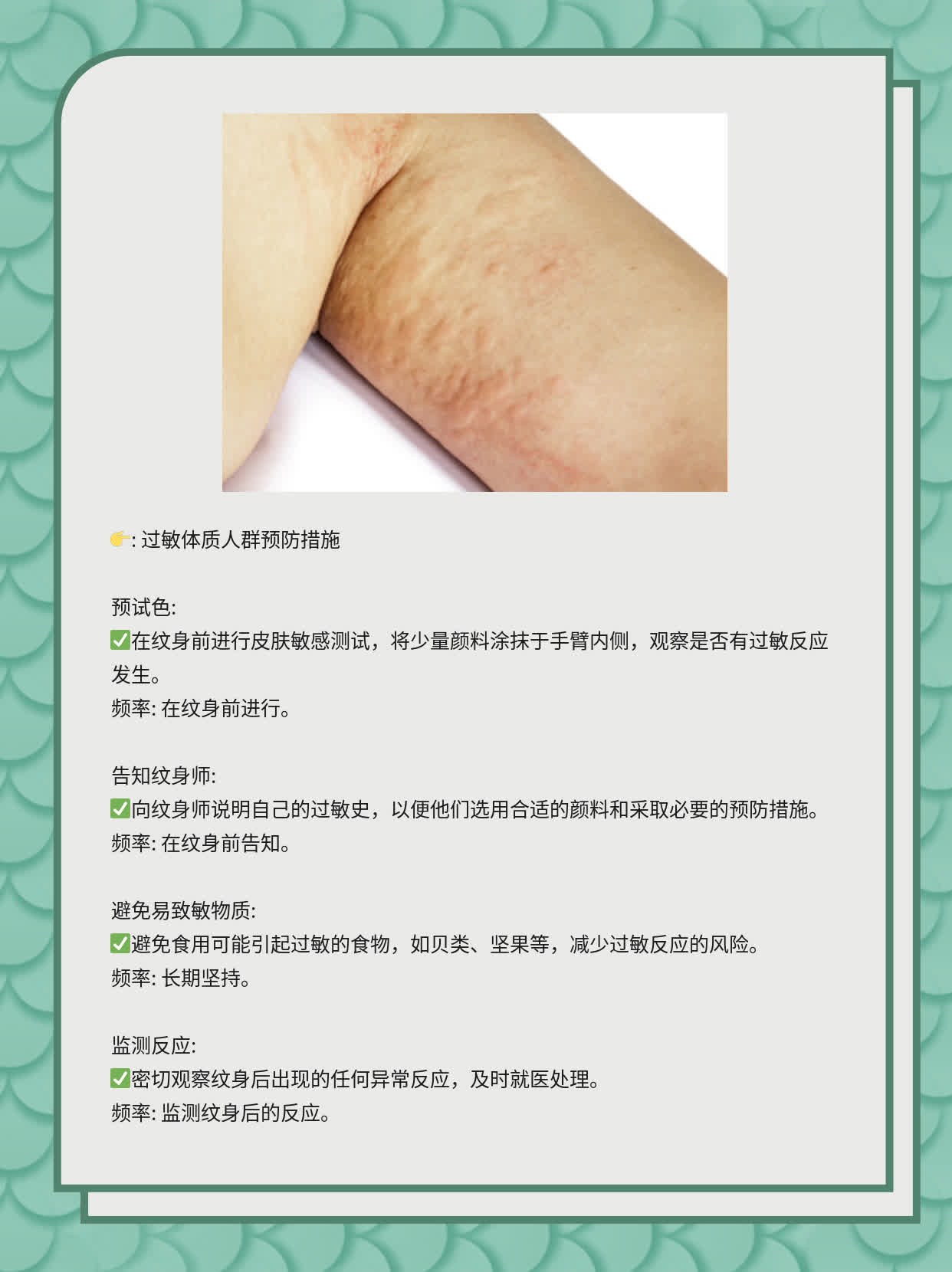 「揭秘纹身」：探索其临床表现及意义！