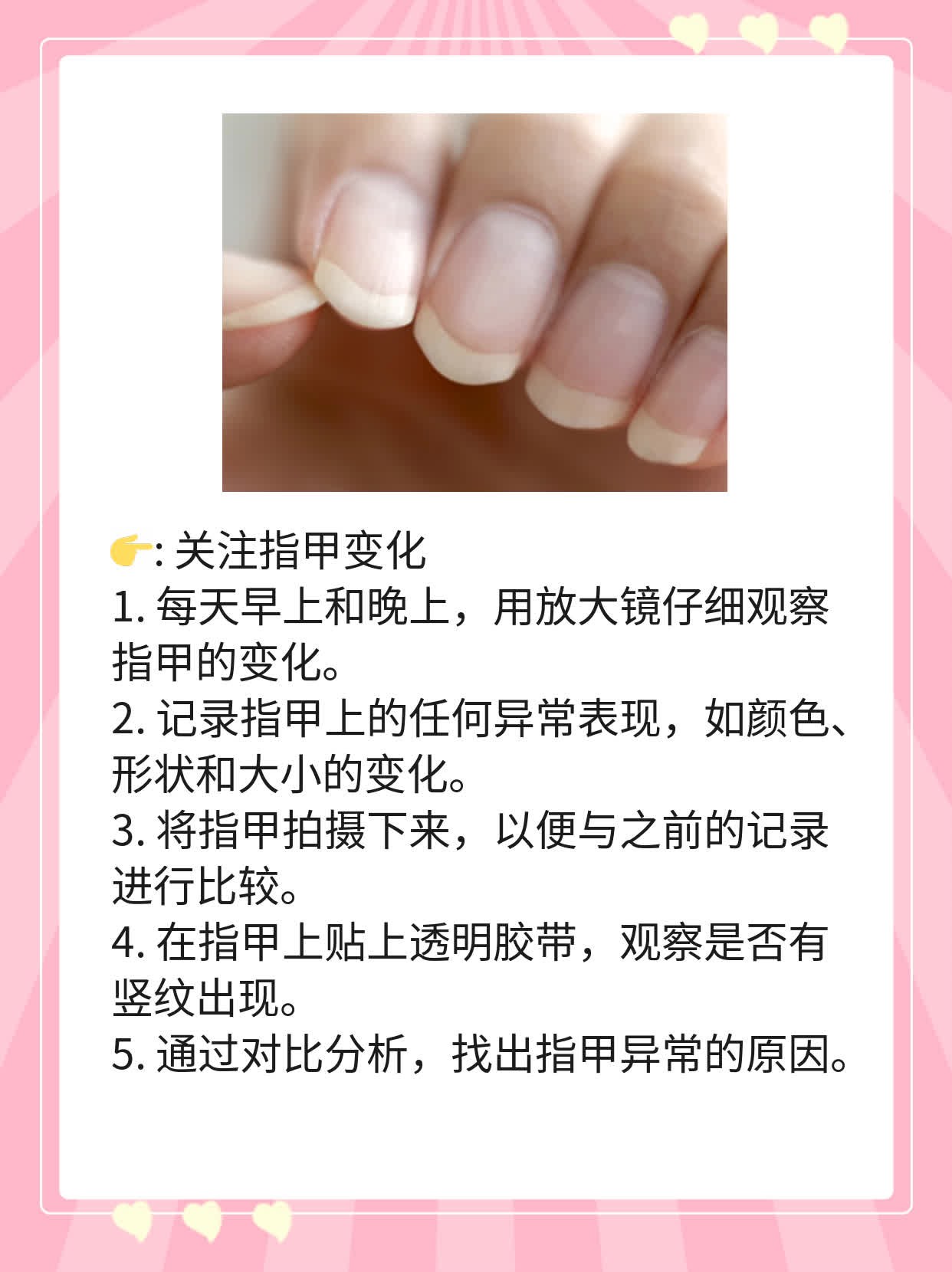 揭秘：指甲上的白色竖纹原因大公开！