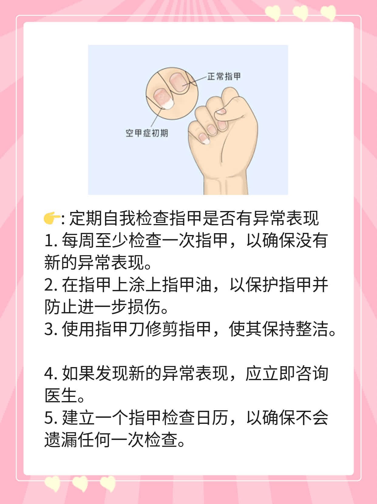 揭秘：指甲上的白色竖纹原因大公开！