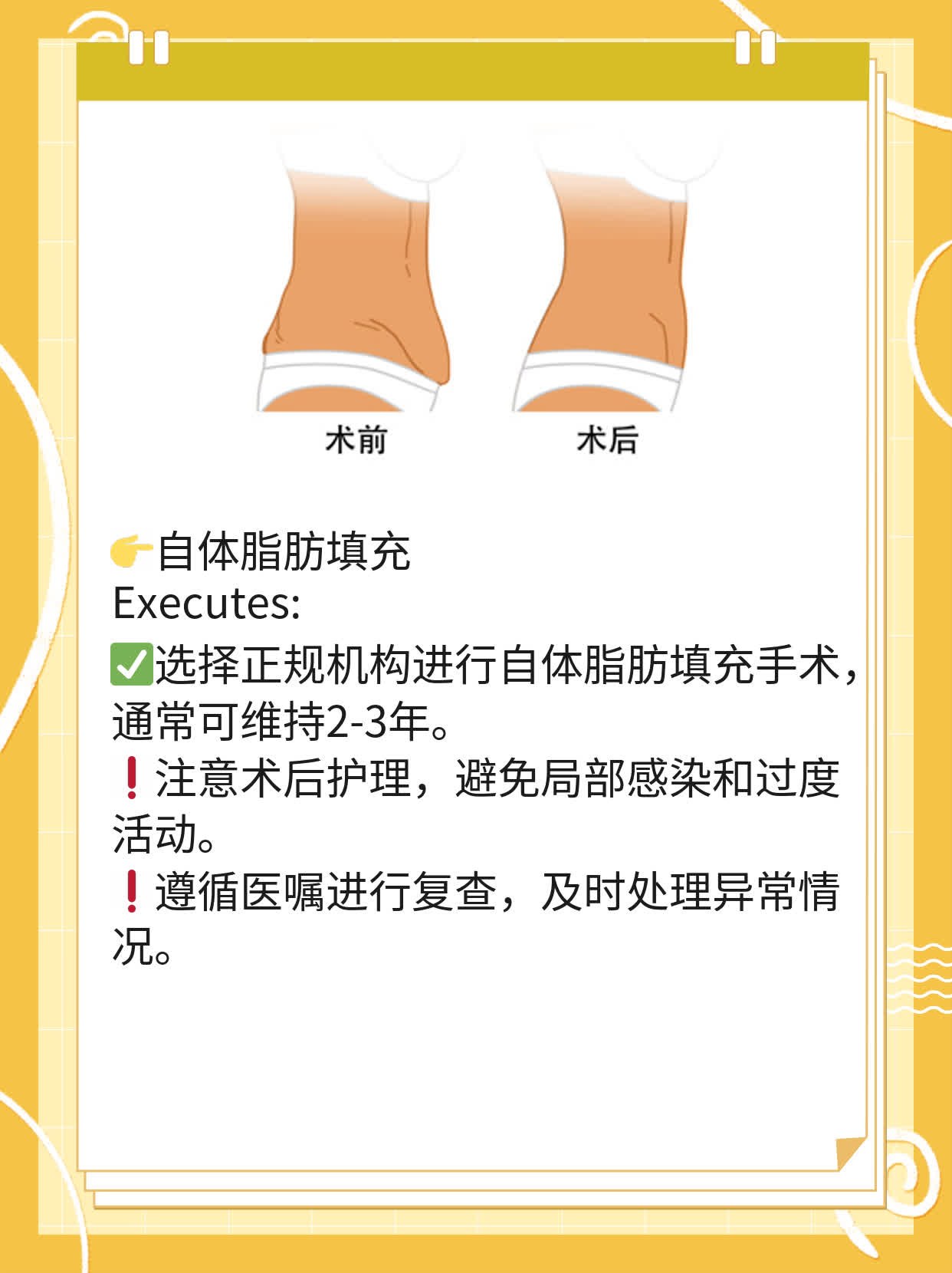 自体脂肪填充法令纹持久度探秘