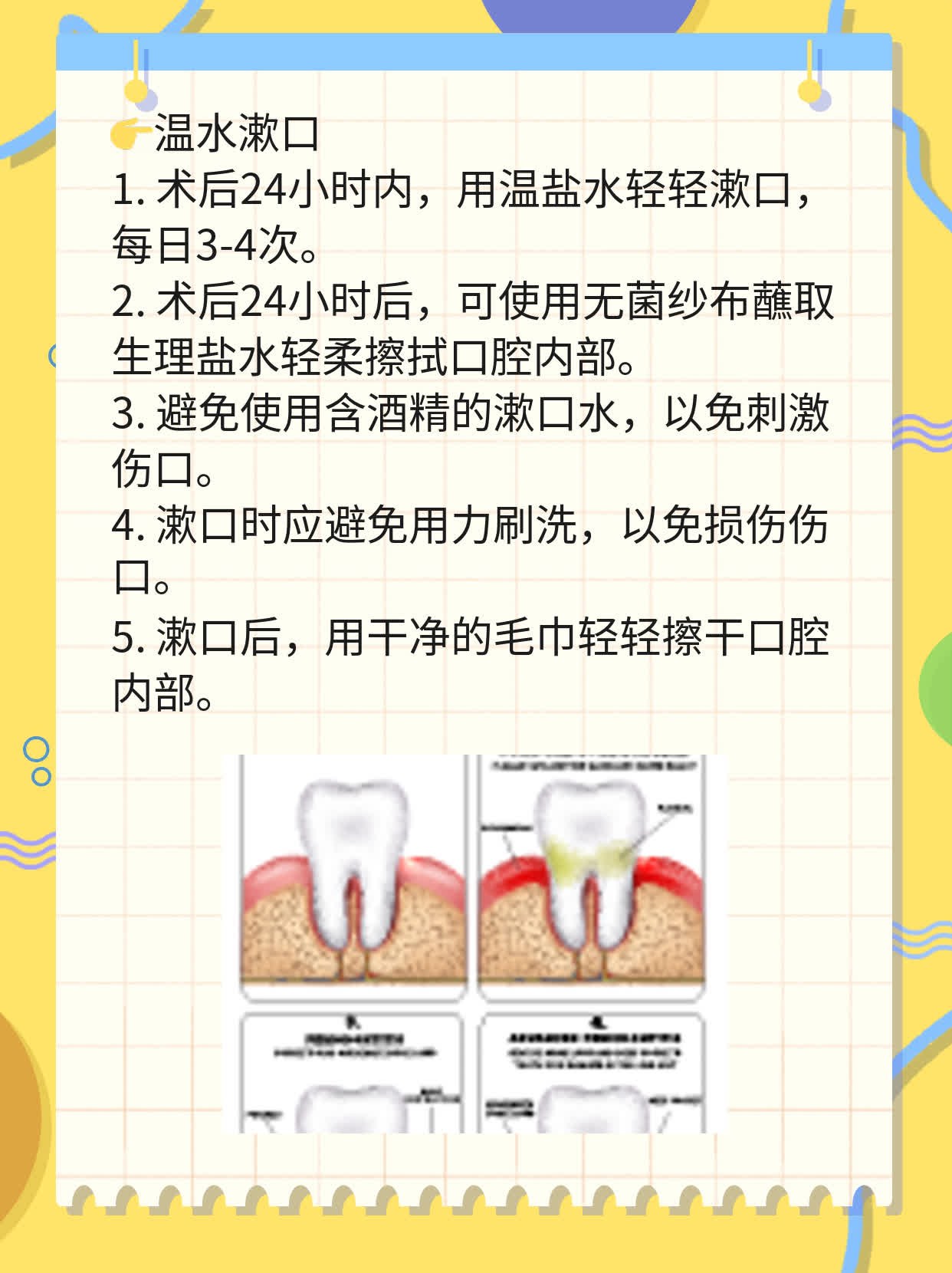 拔牙后多久能吃？探秘术后进食时间！