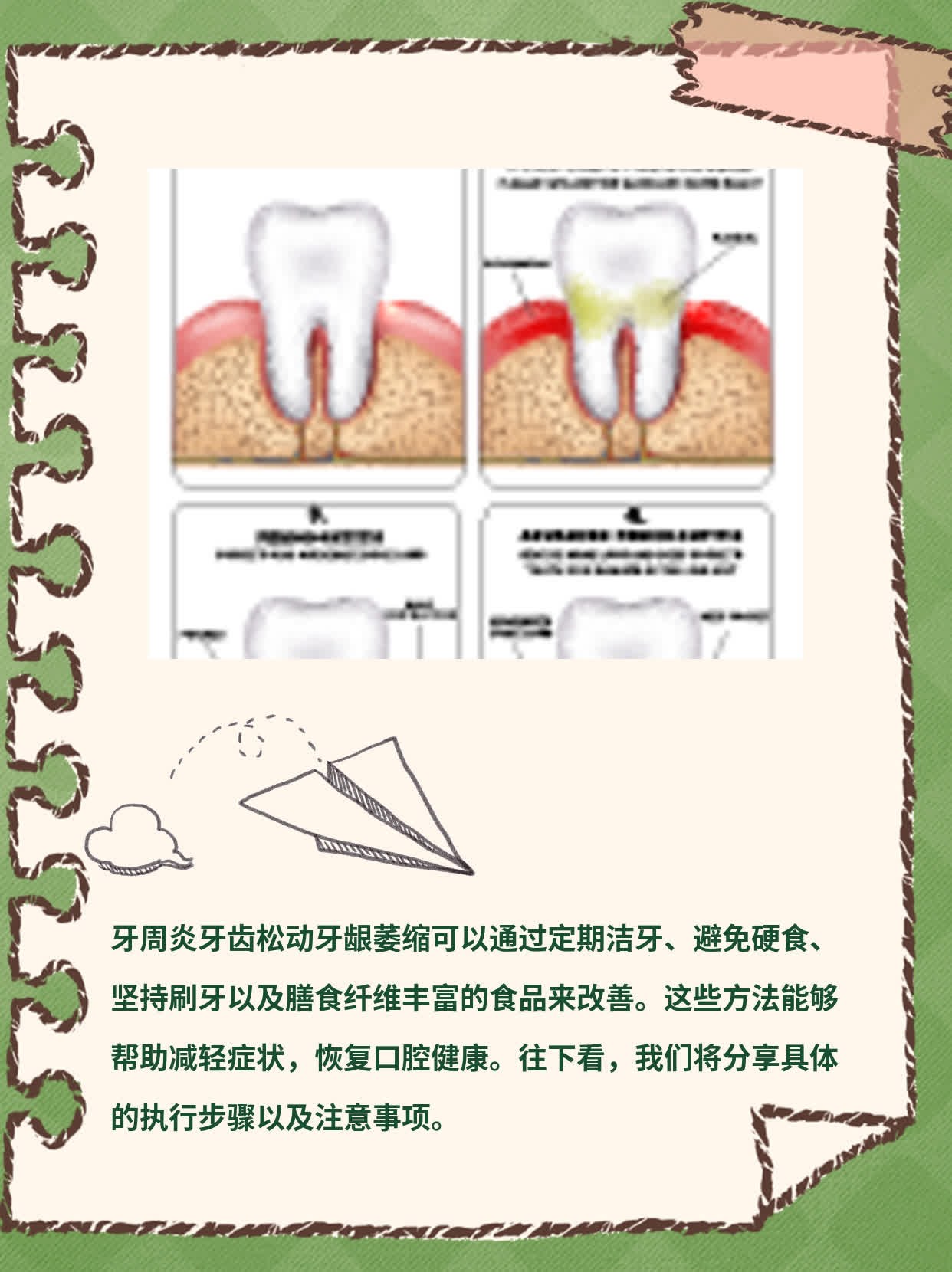 「牙周炎牙齿松动牙龈萎缩」的妙招！