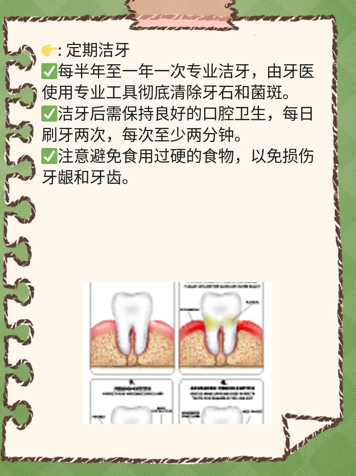 「牙周炎牙齿松动牙龈萎缩」的妙招！