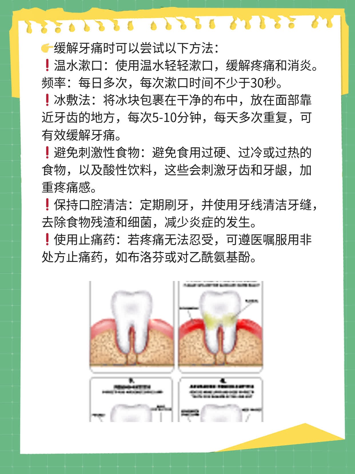 「分享经验」拔智齿：上下区别，你不可不知！