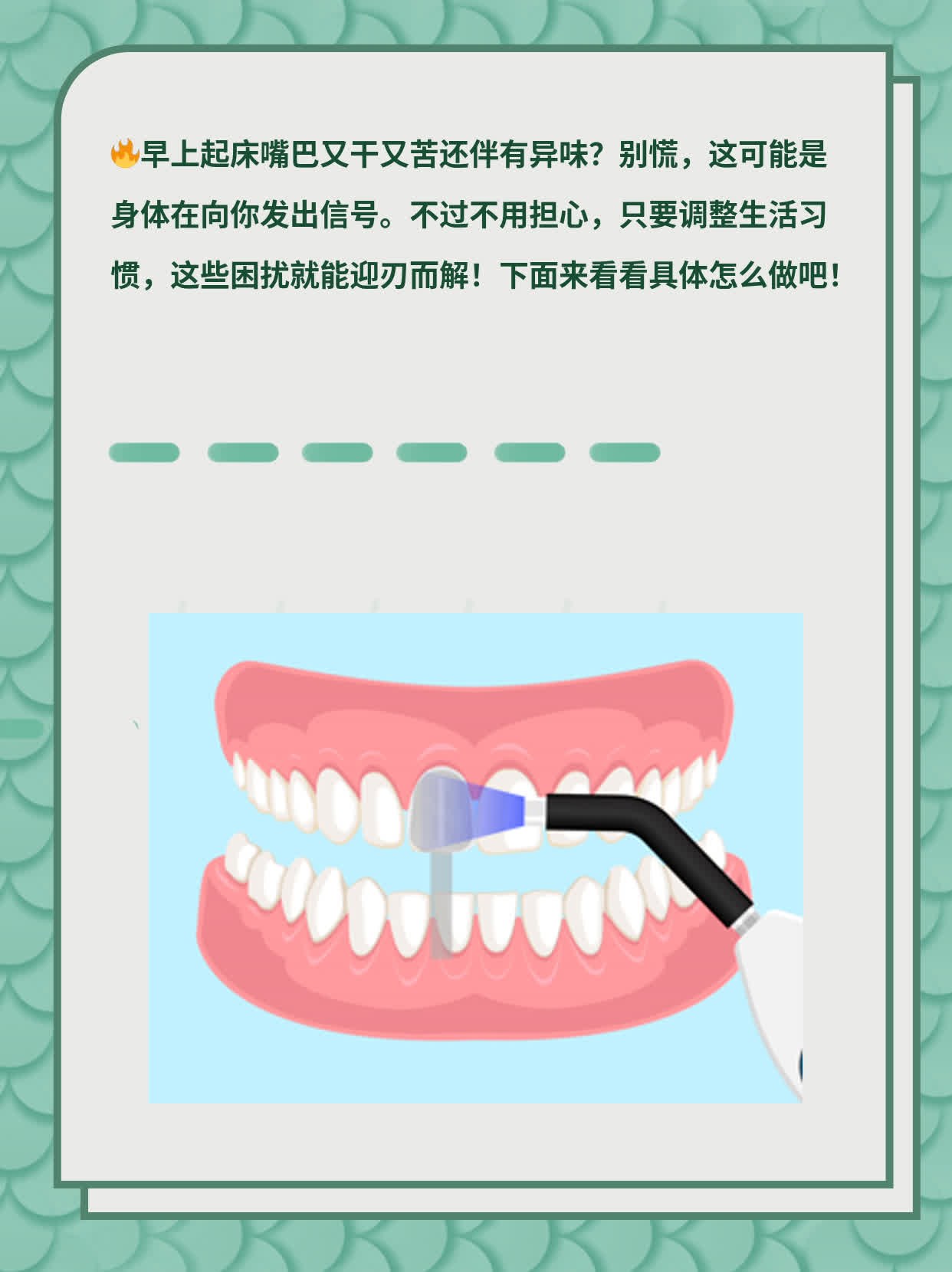 口干、口苦、口臭？晨起困扰揭秘！