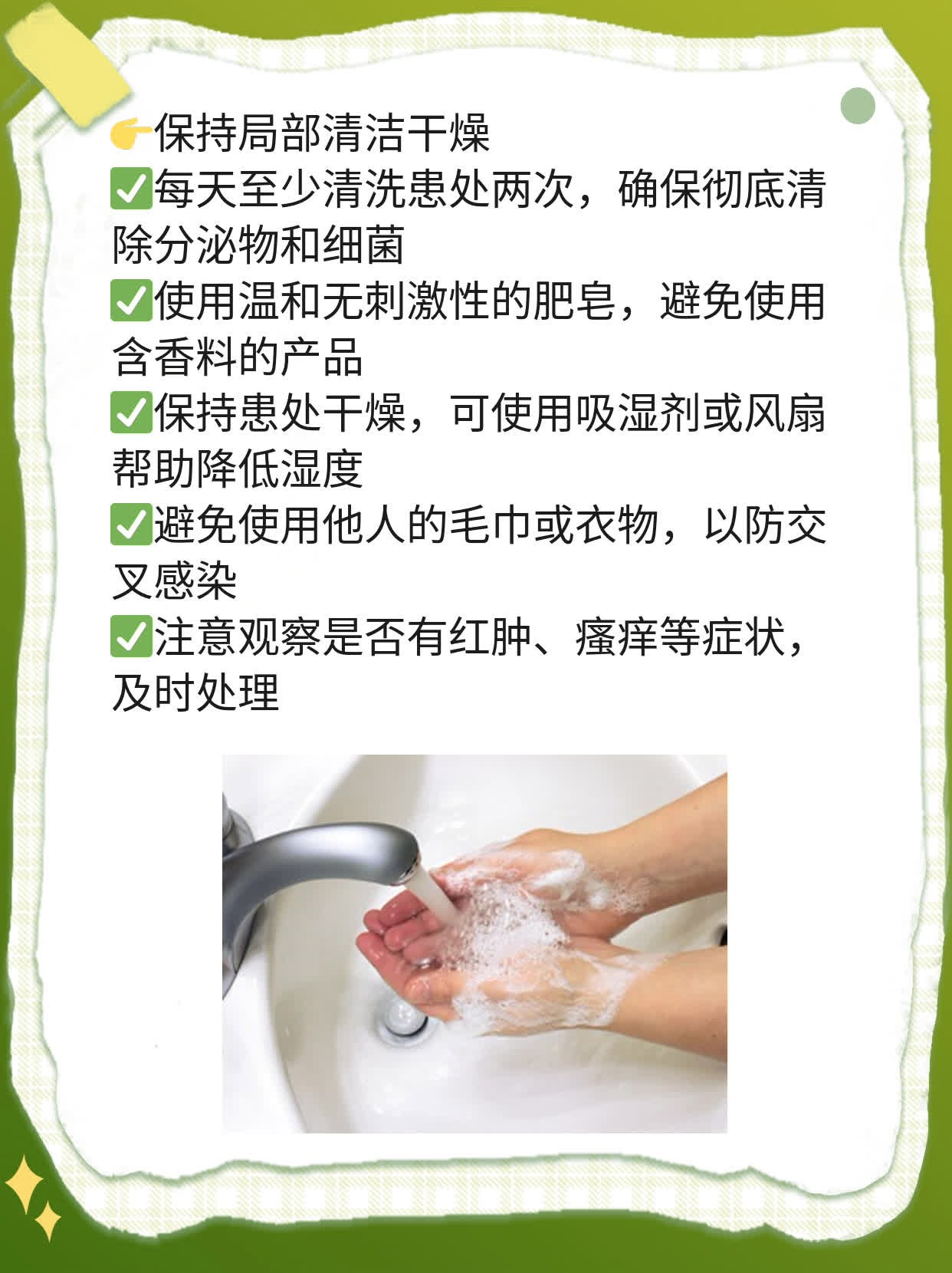 「男生必看」氟康唑治霉菌，吃几天见效？