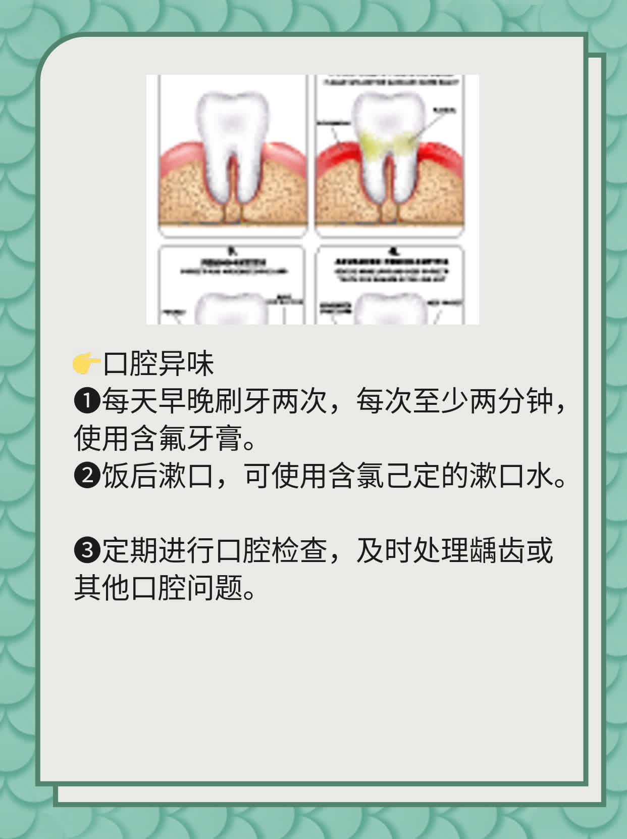 #揭秘全瓷牙VS烤瓷牙：选择适合你的牙齿修复方式！