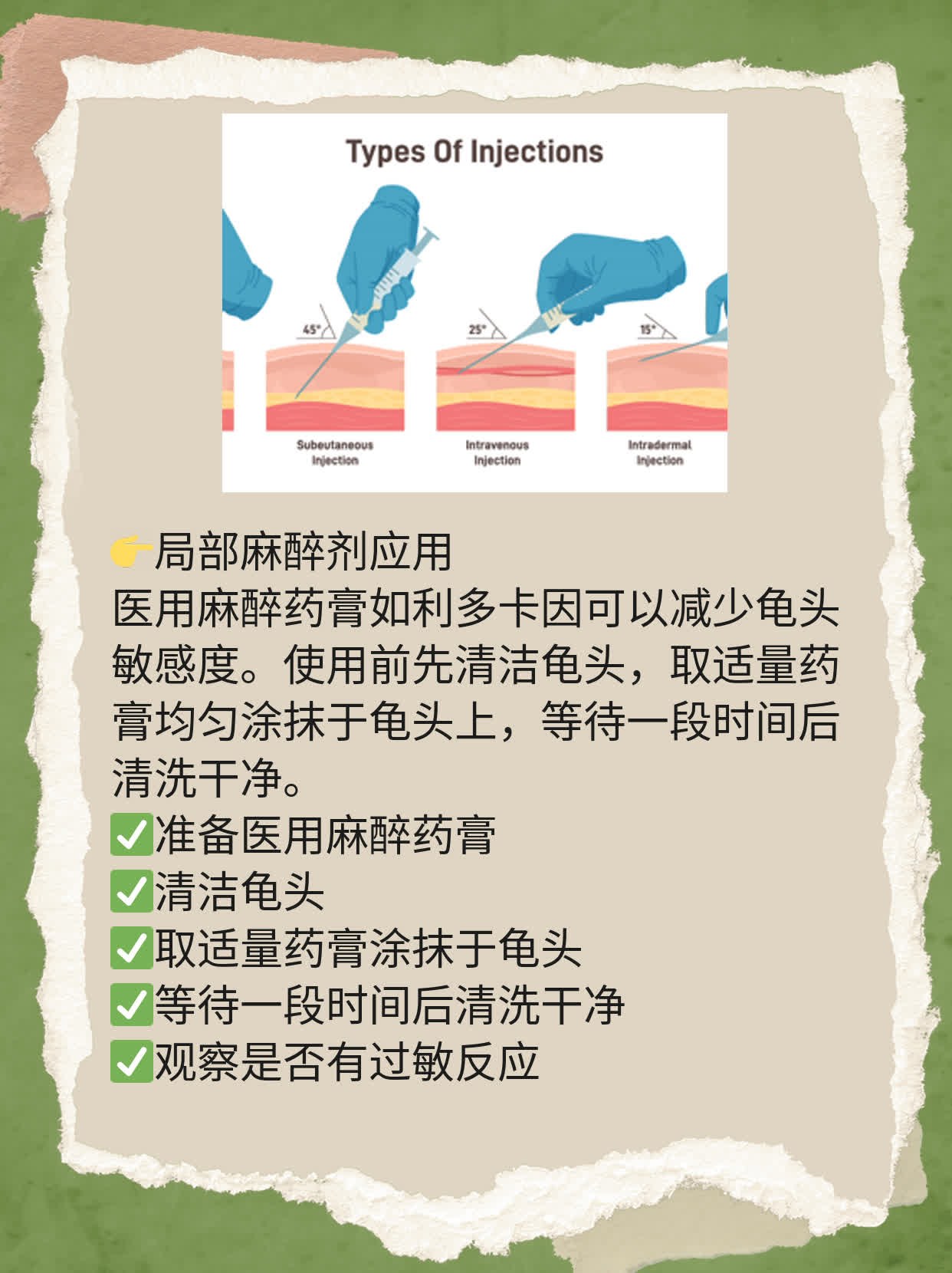 「龟头敏感度」降低法：经验分享！