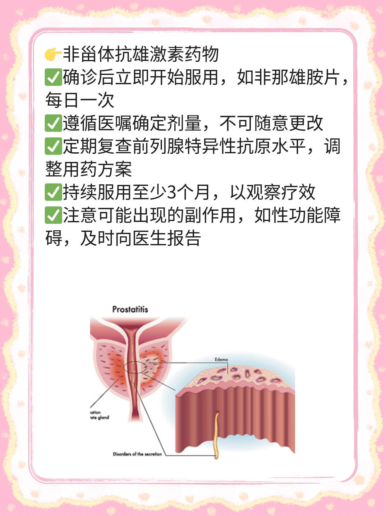「前列腺增生」：揭秘特效药物！