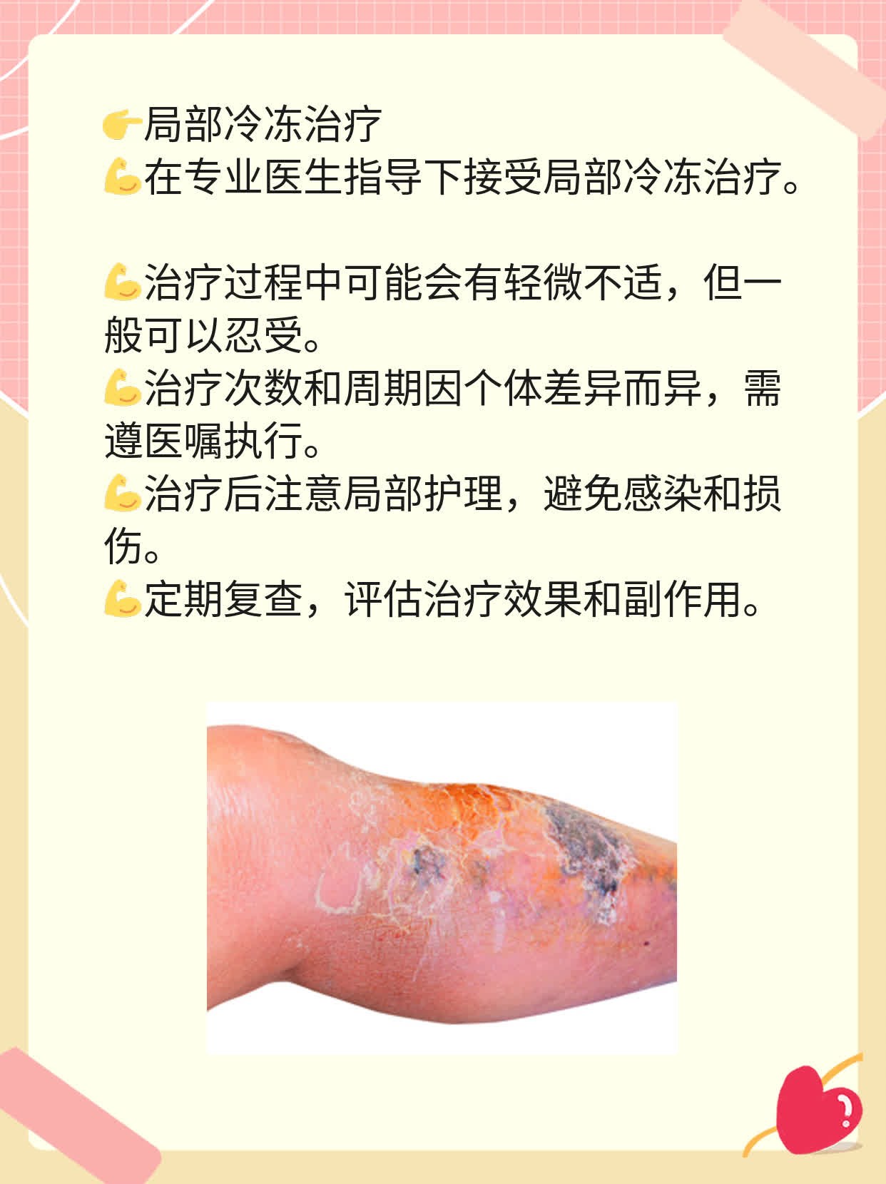 认识传染性软疣：症状解析