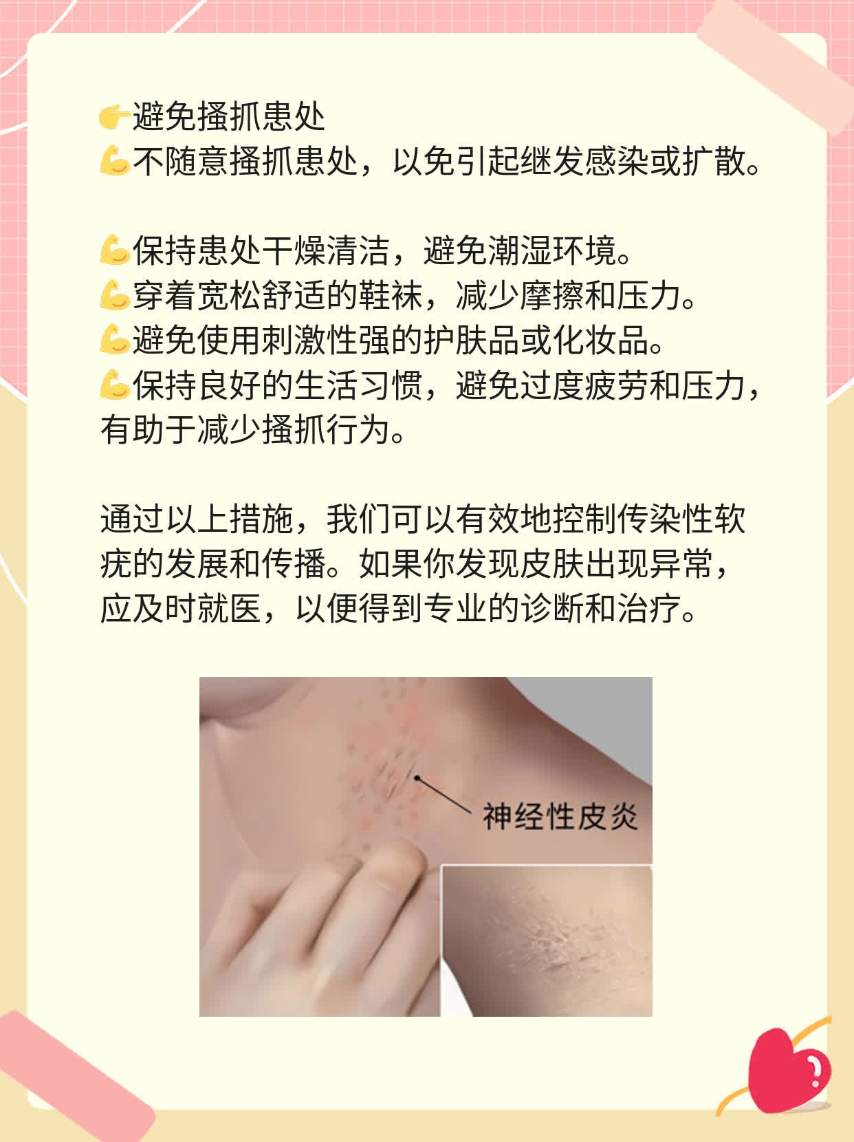 认识传染性软疣：症状解析