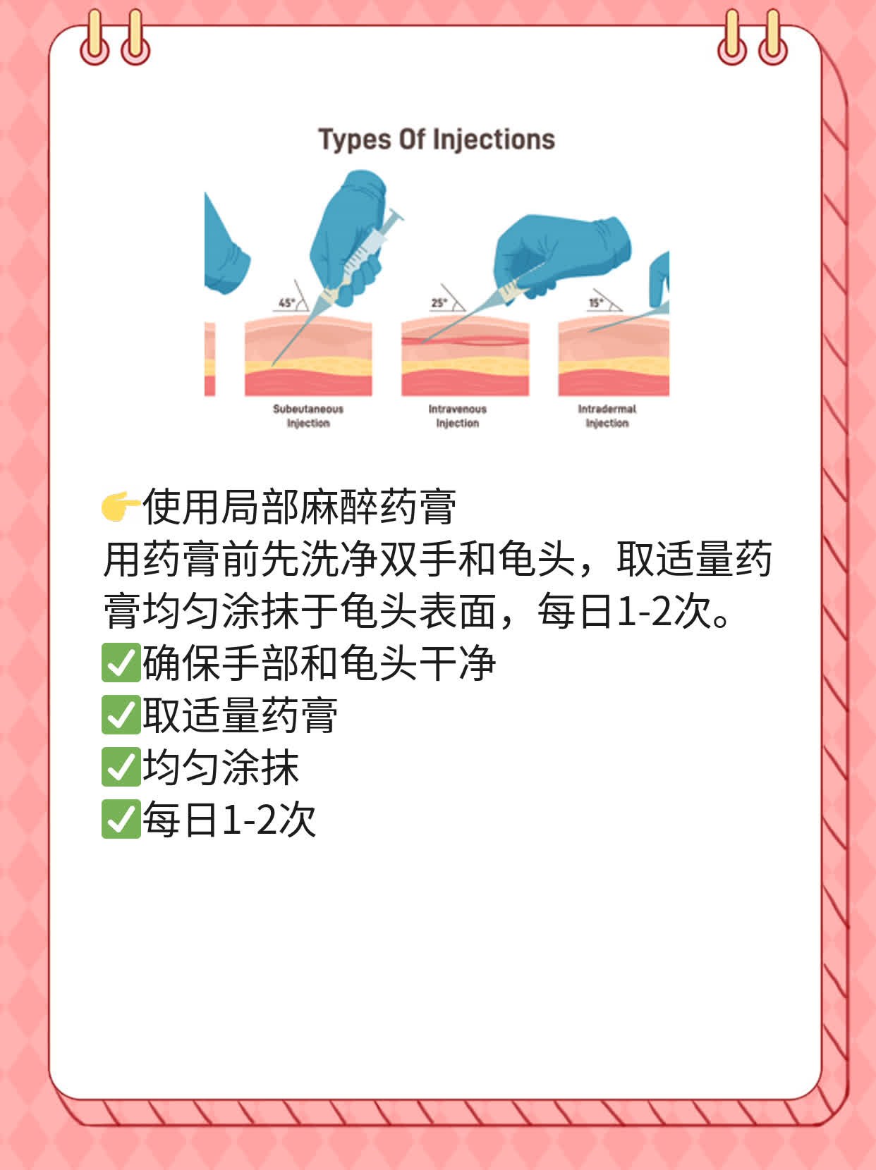 「经验分享」龟头敏感？试试复方利多卡因软膏！