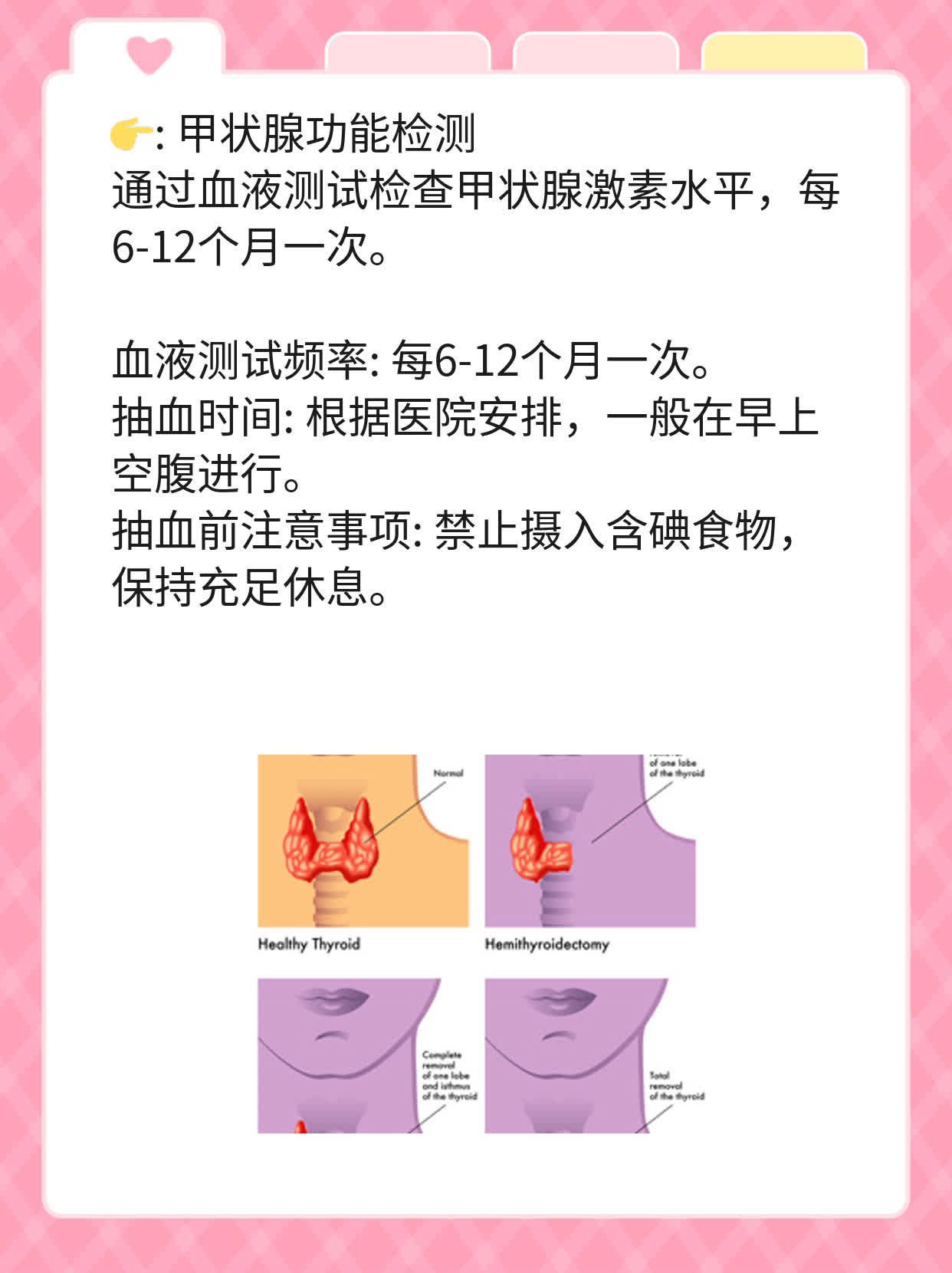 甲状腺结节4a级攻略：治疗秘籍大公开！