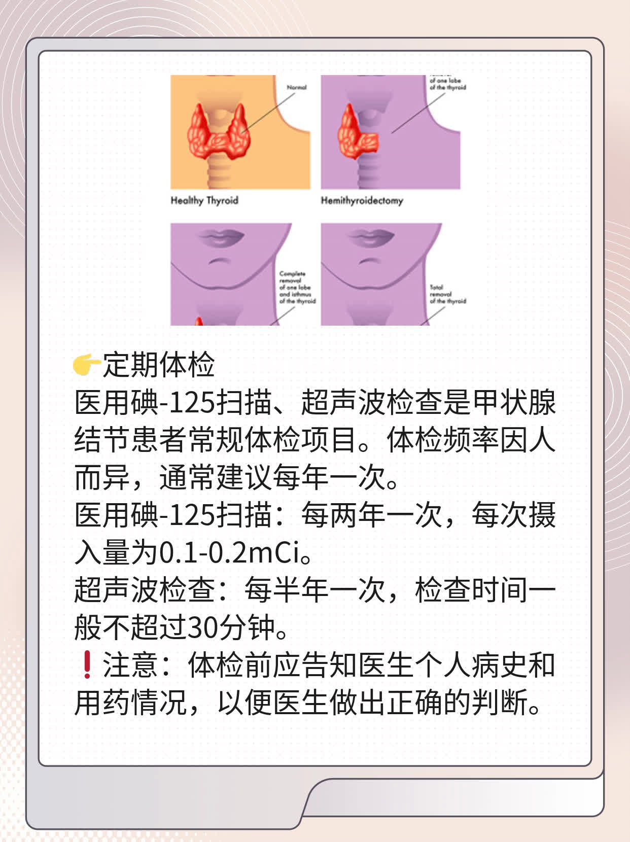 揭秘：甲状腺结节患者的饮食攻略