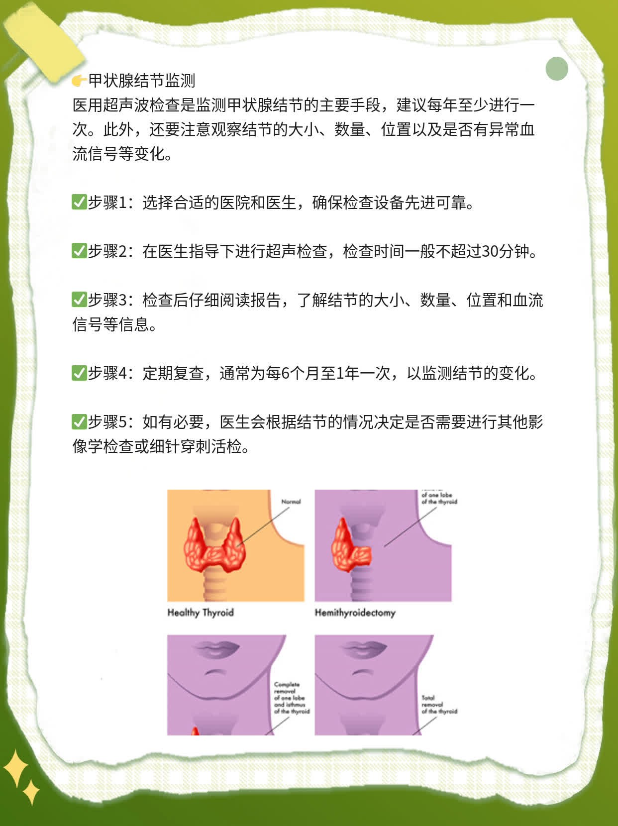 揭秘：甲状腺结节的症状及危害，你必须知道！