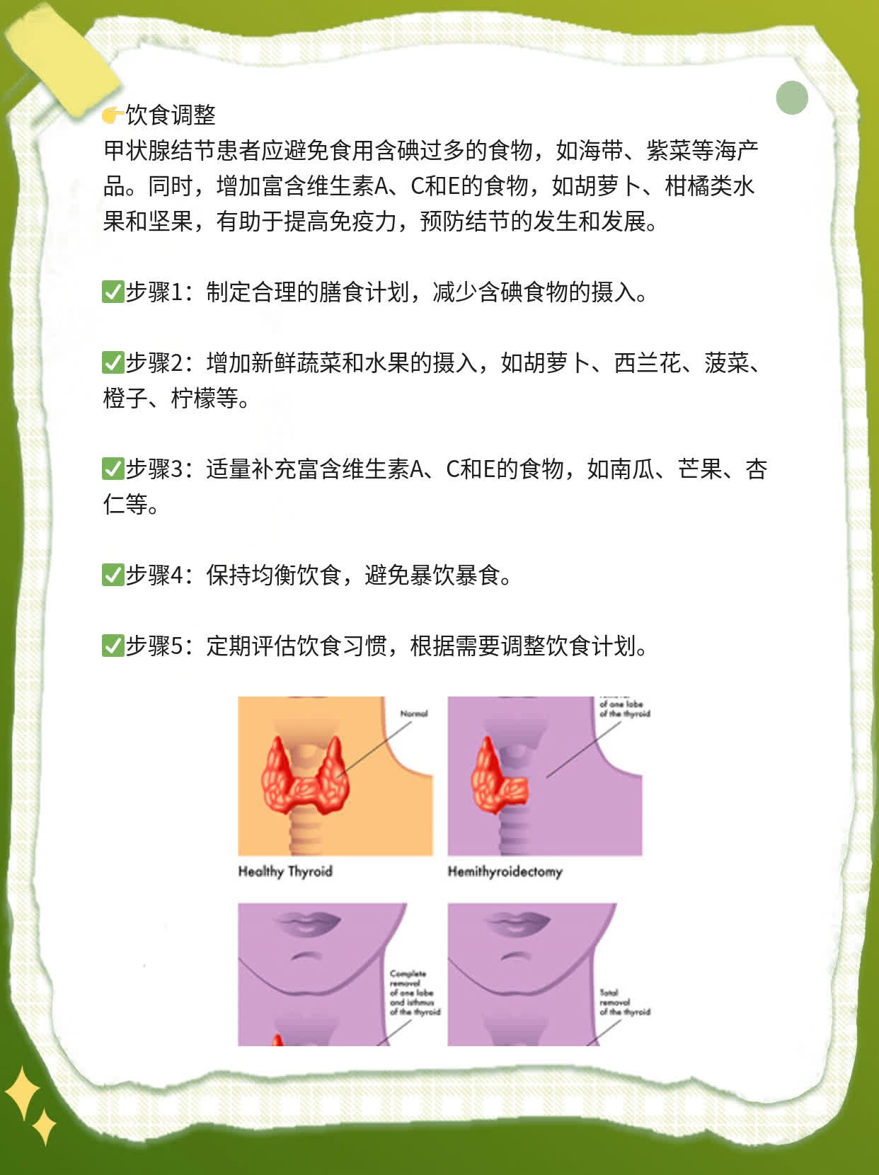 揭秘：甲状腺结节的症状及危害，你必须知道！